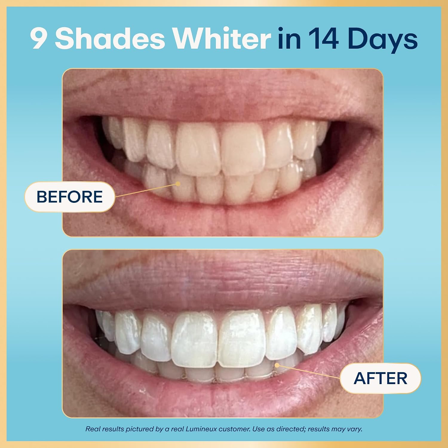 Detalle de Lumineux Whitening Strips Kit 9 Treatments