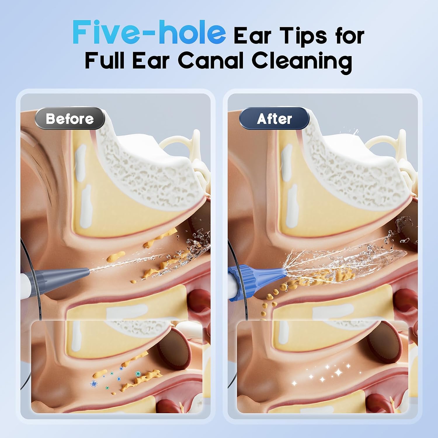 Detalle 2 de Electric Ear Wax Removal Kit with 500ml Bottle