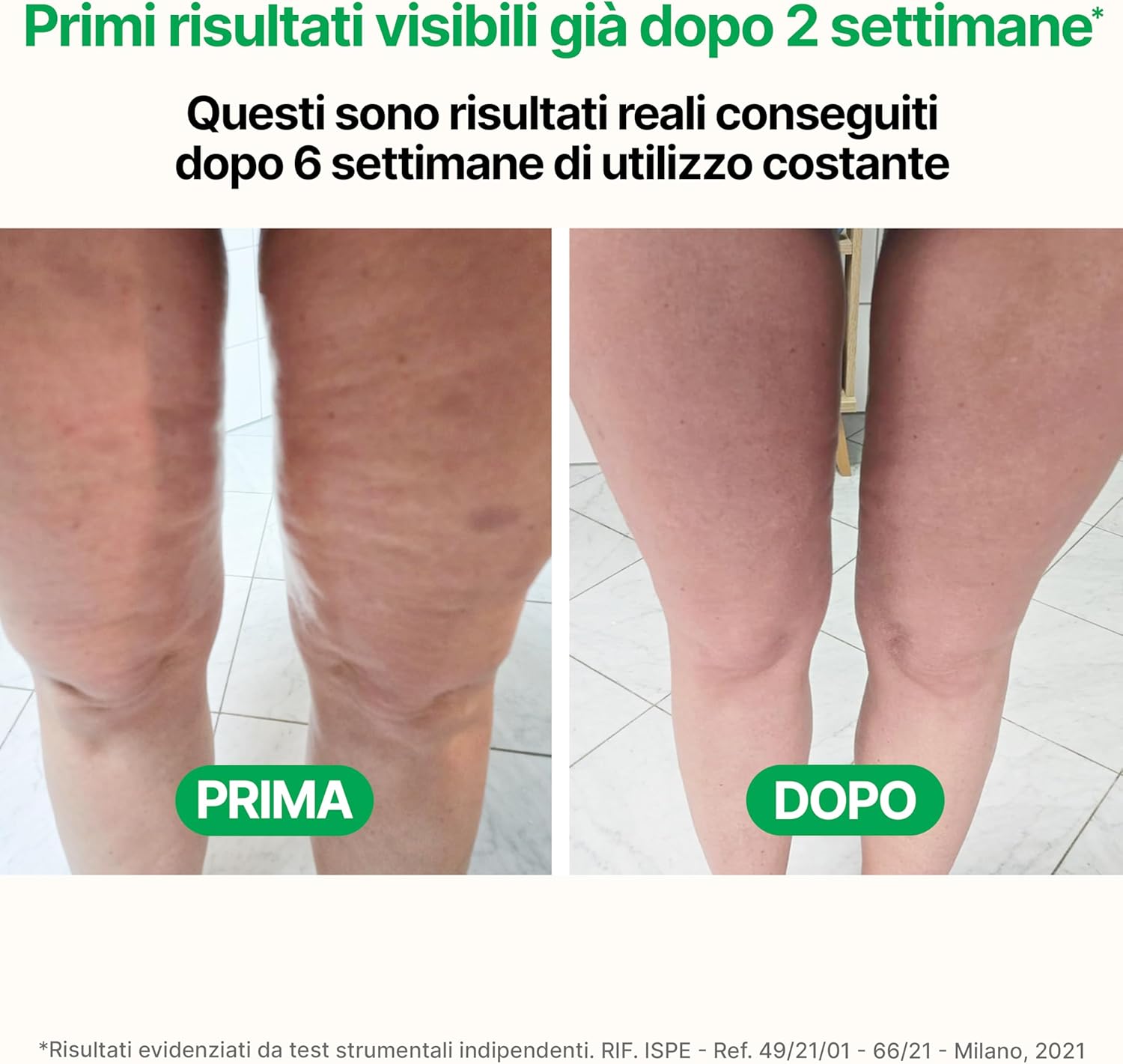 Detalle 2 de TESMED CELLULITE massaggiatore anticellulite 9–38 cm 💆