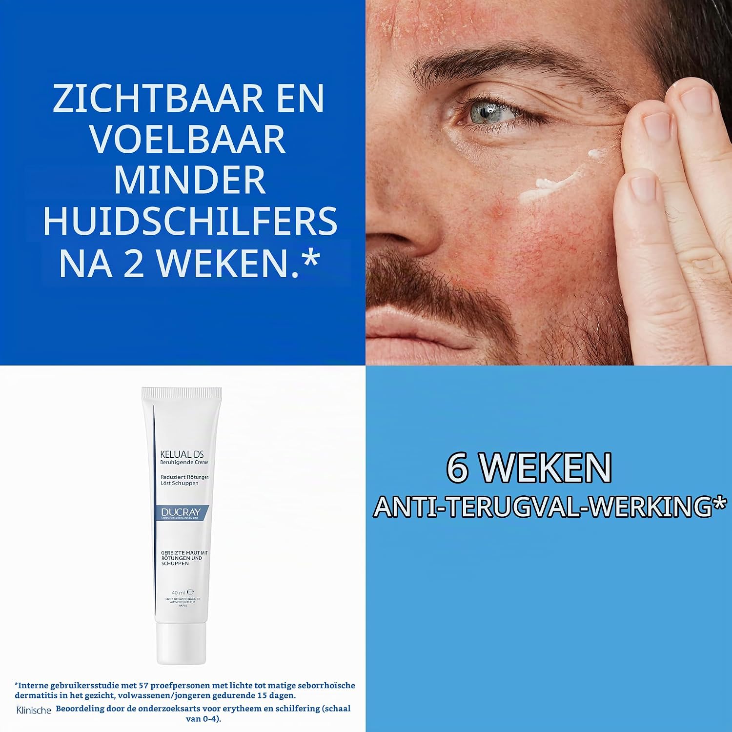 Detalle de Ducray Kelual DS crème 40 ml voor volwassenen