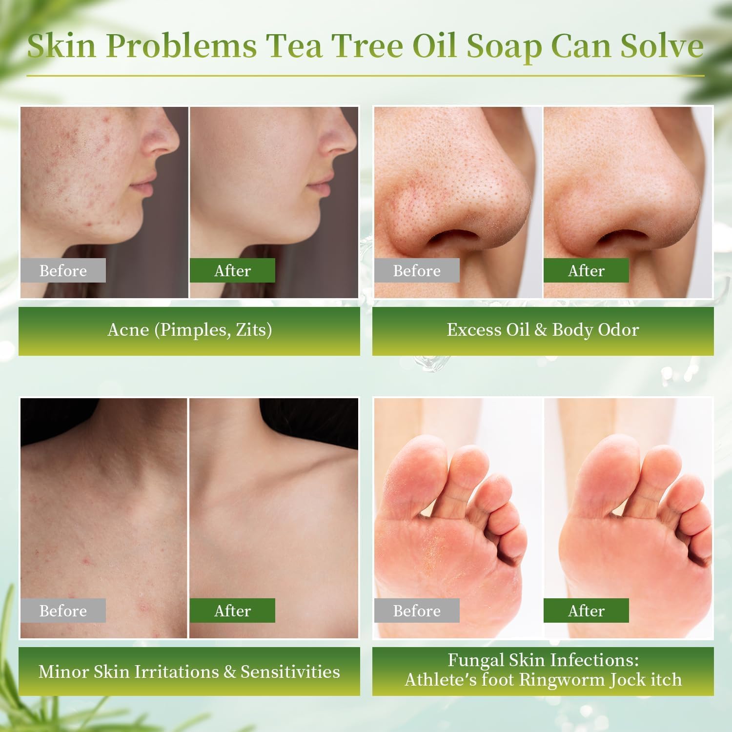 Thumbnail 4 de YIREG Tea Tree Soap 3-Pack, 100 g Bars for Face, Body & Hands