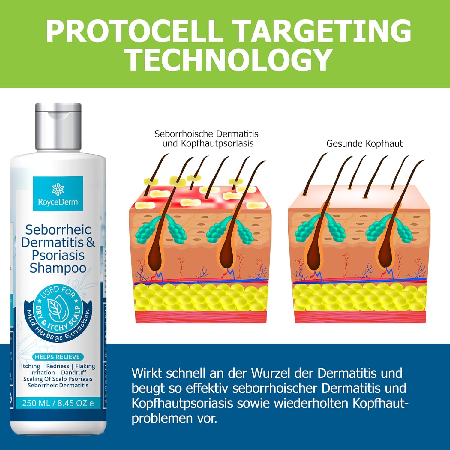 Thumbnail 2 de RoyceDerm Seborrhoisches Schuppenflechte Shampoo für Kopfhaut und Körper