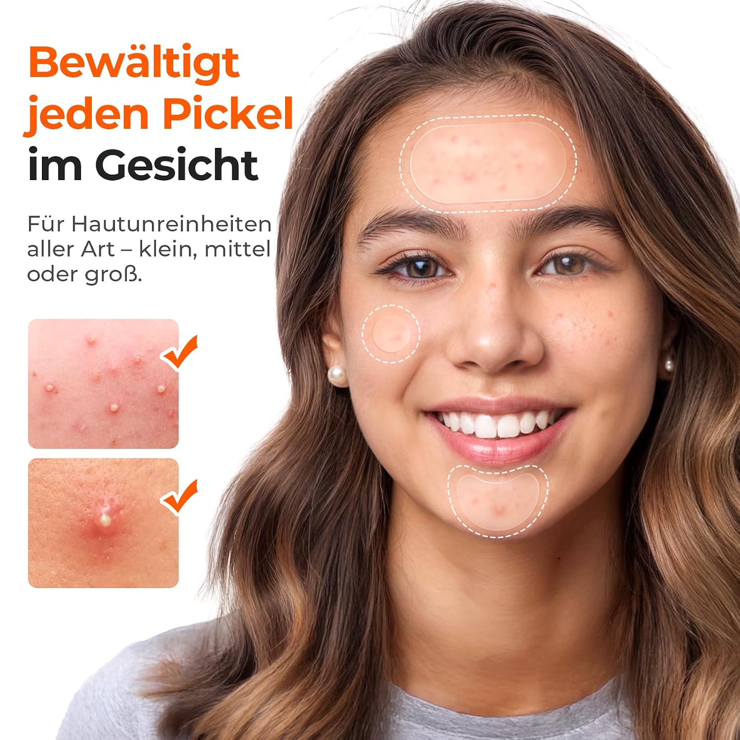Detalle de TKTK 443 Pickel-Patches Gesicht – Hydrokolloid Großpackung, 5 Größen für Wangen, Stirn, Kinn