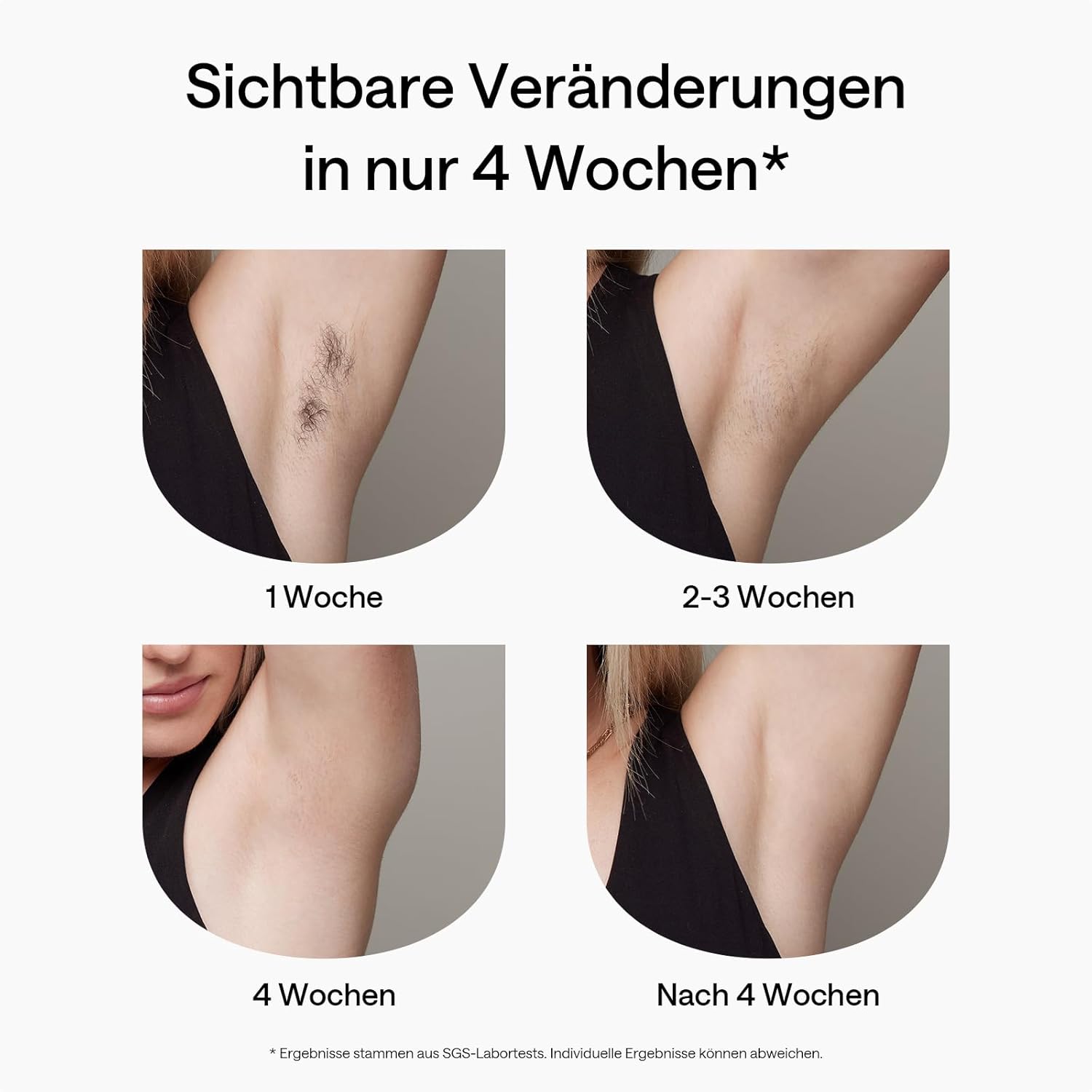 Thumbnail 3 de Ulike Air 2 IPL Haarentfernung – sanfte, nahezu schmerzfreie Skalierung für Körper und Gesicht
