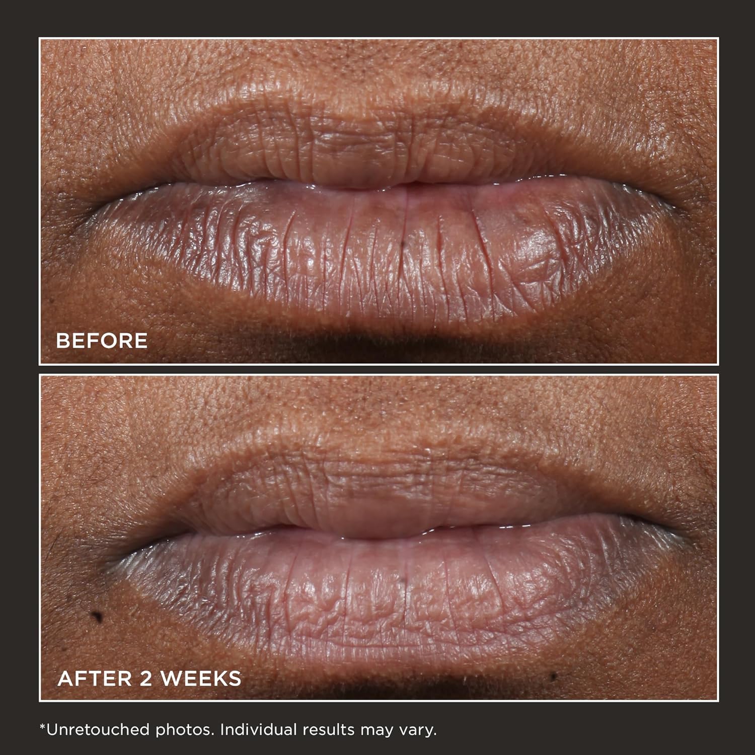 Thumbnail 3 de Perricone MD Cold Plasma Plus+ Lip Therapy 4.2 g: trattamento labbra multi-azione, idratante e nutriente
