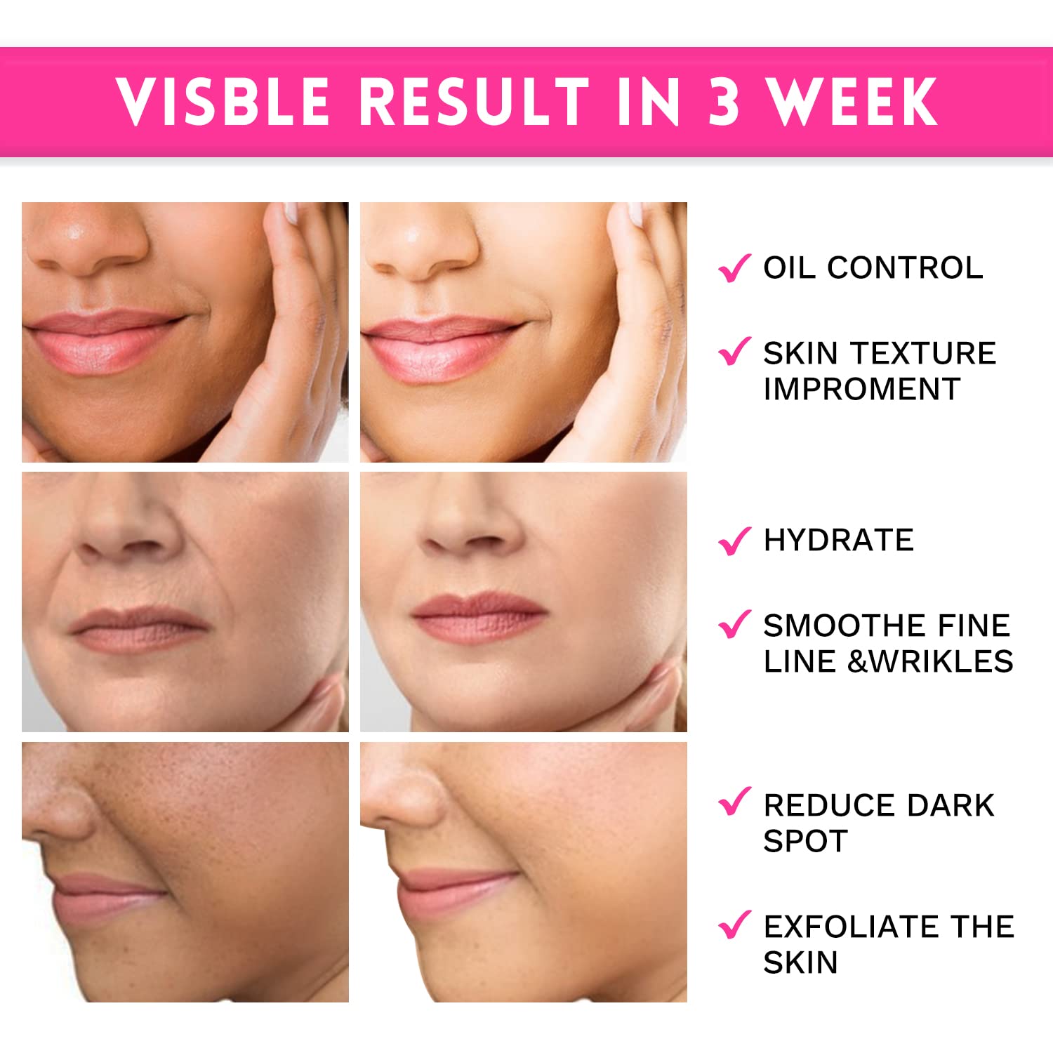 Thumbnail 3 de ANAiRUi Glykolsäure Peel Pads AHA Resurfacing – Gesichtspads mit Vitaminen B5, C & E, Hexenhasel & Calendula