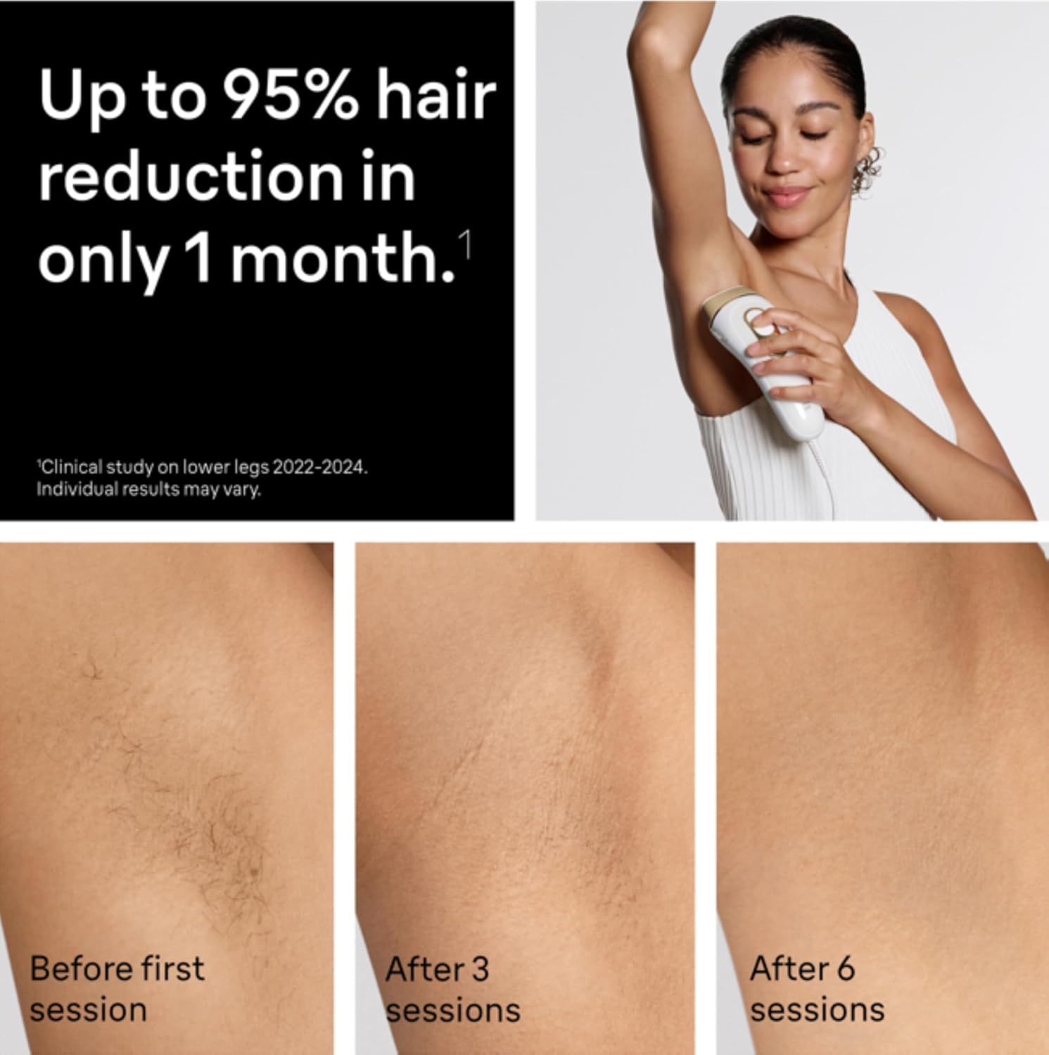 Detalle de Braun Silk Expert Pro5 IPL PL5157 long-lasting at-home laser hair removal device with Venus razor