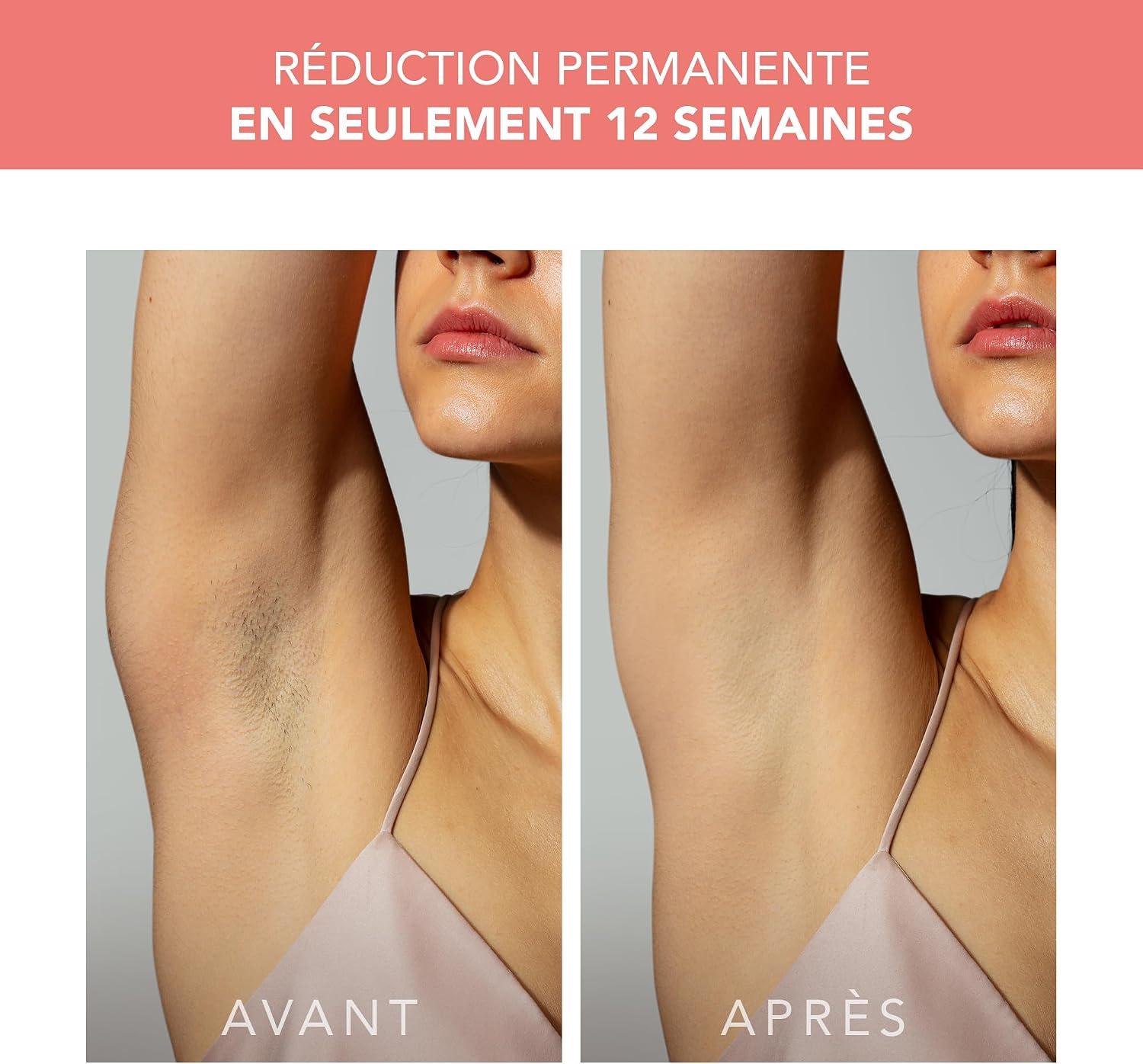 Detalle de FOREO Peach 2 IPL – Épilateur lumière pulsée 10 minutes, confort et couverture optimisés