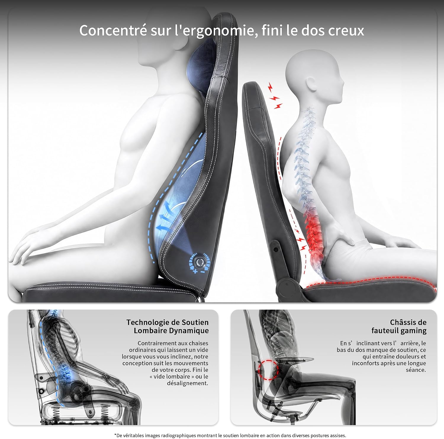 Detalle de JUMMICO Sedia da Ufficio Ergonomica con Supporto Lombare Dinamico e Poggiapiedi: comfort prolungato per home office