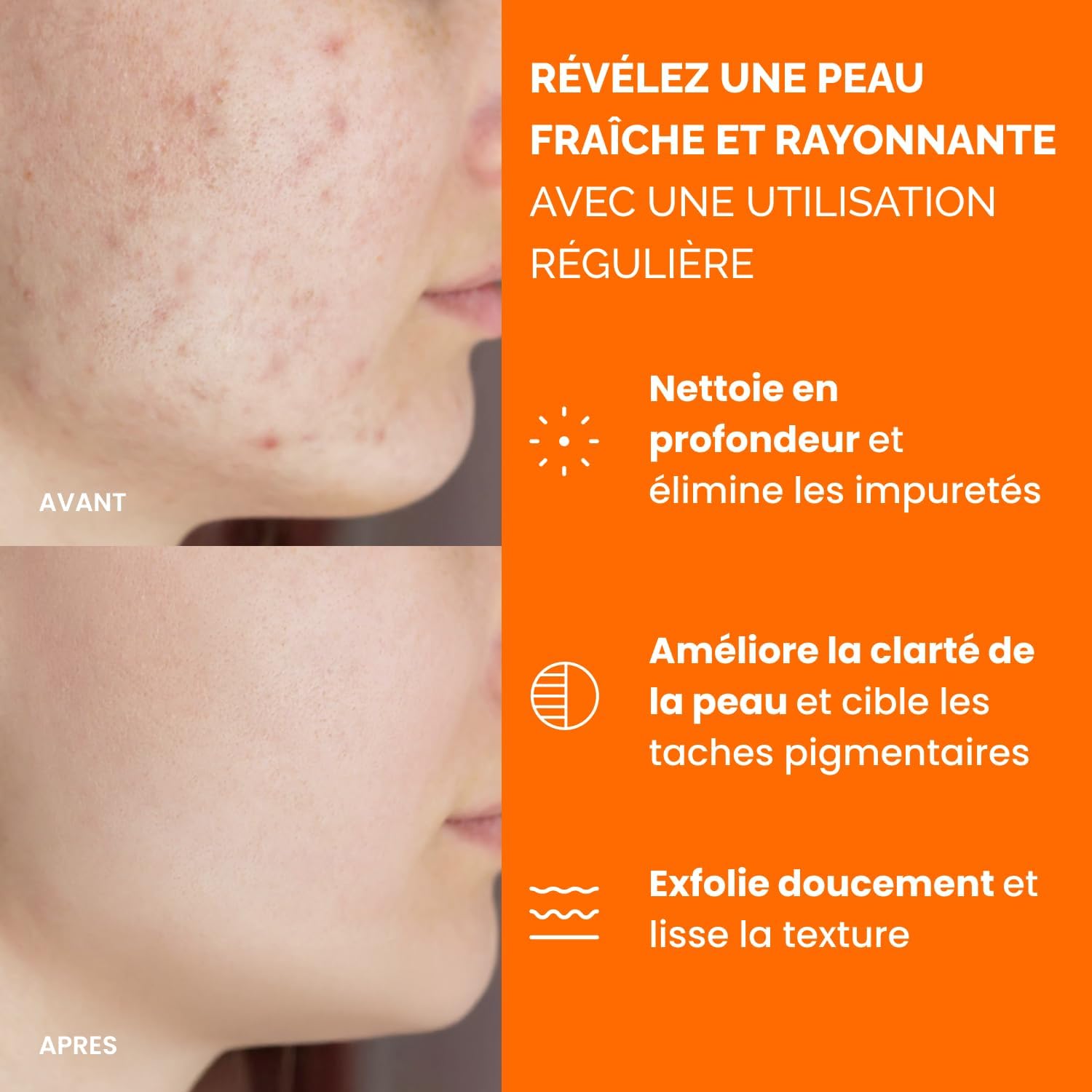 Detalle de PLANTIFIQUE Disques Nettoyants au Curcuma et Acide Kojique avec Céramides, Niacinamide et Vitamine C – 60 Disques Exfoliants Visage