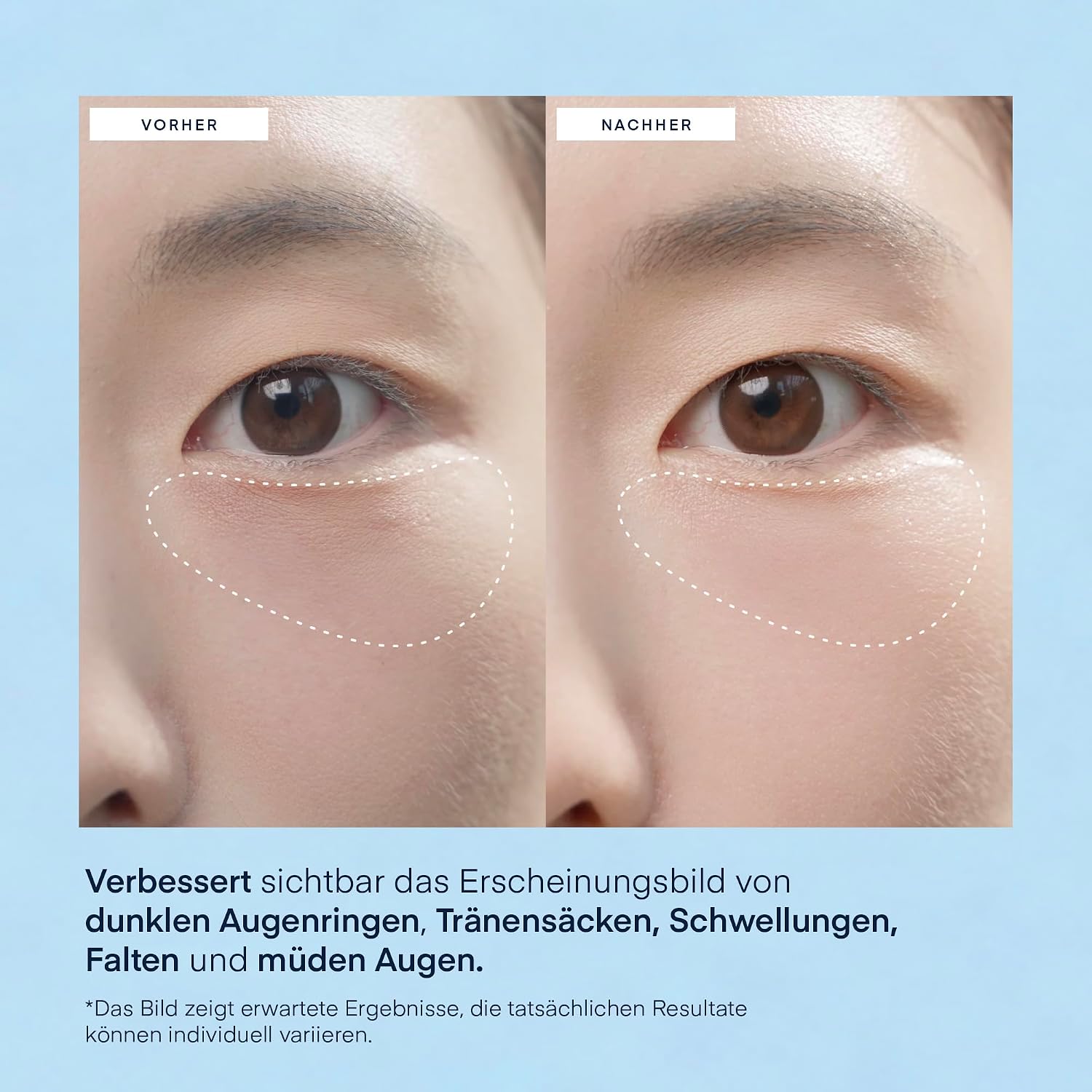 Thumbnail 3 de TEREZ & HONOR Augenpads gegen Augenringe
