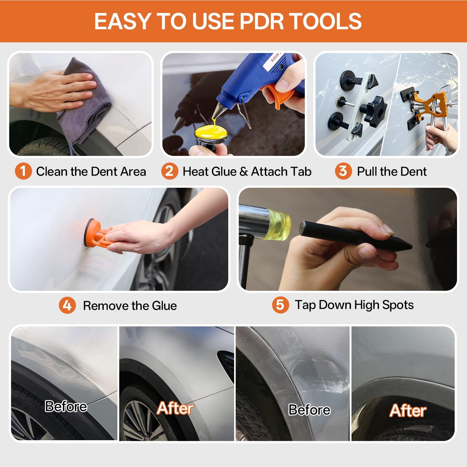 Detalle de AUTOPDR Paintless Dent Repair Kit for Car — PDR Dent Removal Tools with Dent Lifter & Pro Dent Puller Tabs