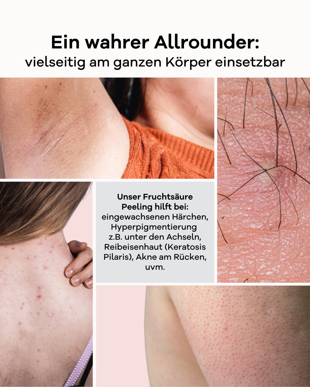 Thumbnail 3 de Zellerneuernd Fruchtsäure Peeling mit 14% AHA und Grüntee-Extrakt (vegan), 100 ml