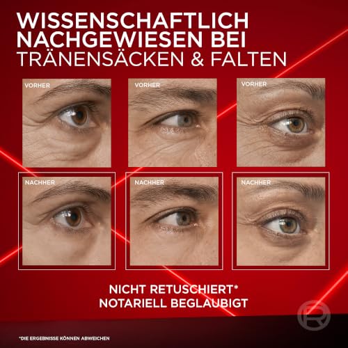Thumbnail 6 de L'Oréal Paris Anti-Tränensack Sofort Lifting – Revitalift Laser: Sofortige Straffung für Augenpartie (15 ml)