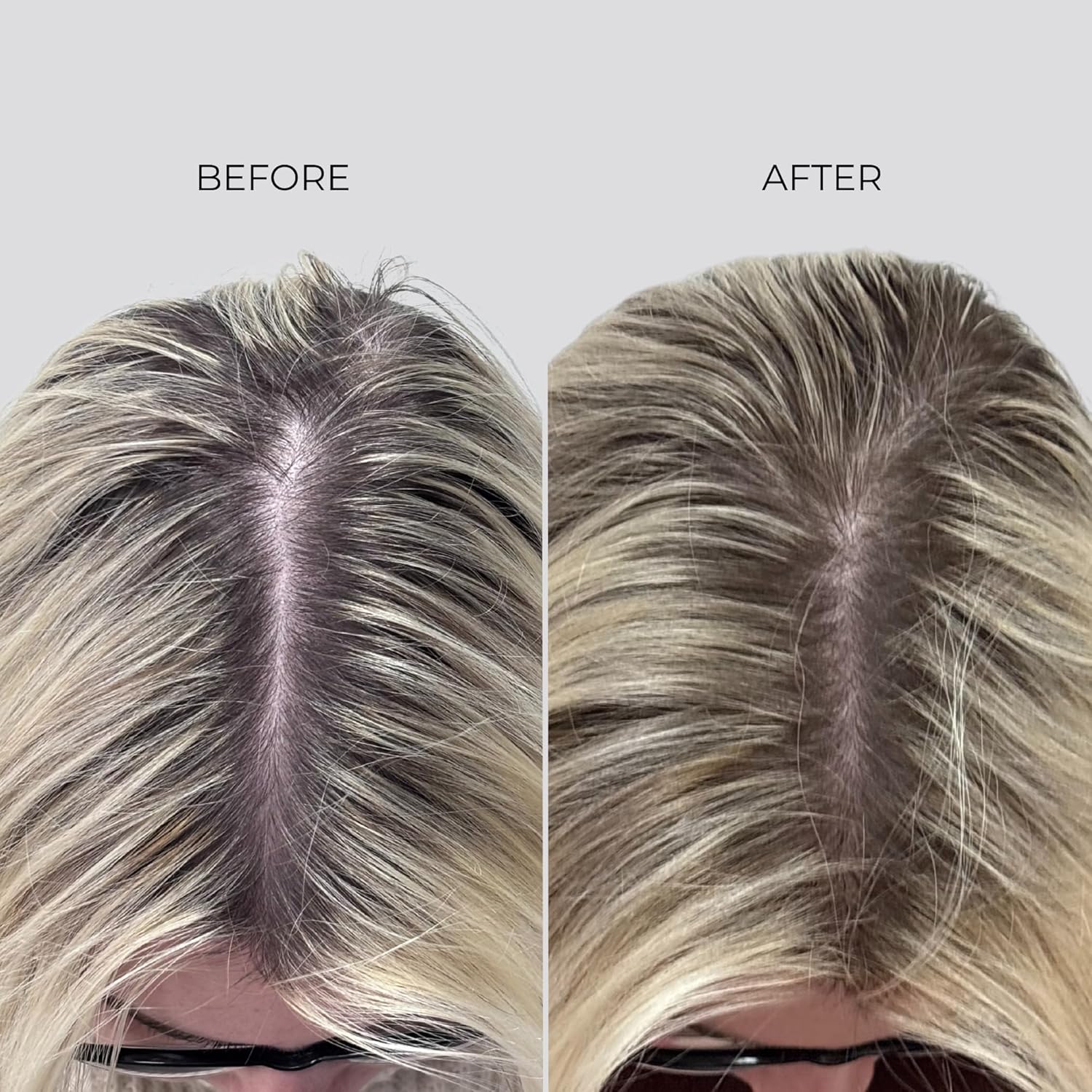 Thumbnail 6 de Nanogen Hair Growth Factor Treatment – sérum pour la pousse des cheveux à l’extrait de pea sprout, écorce et peptides (30 ml)