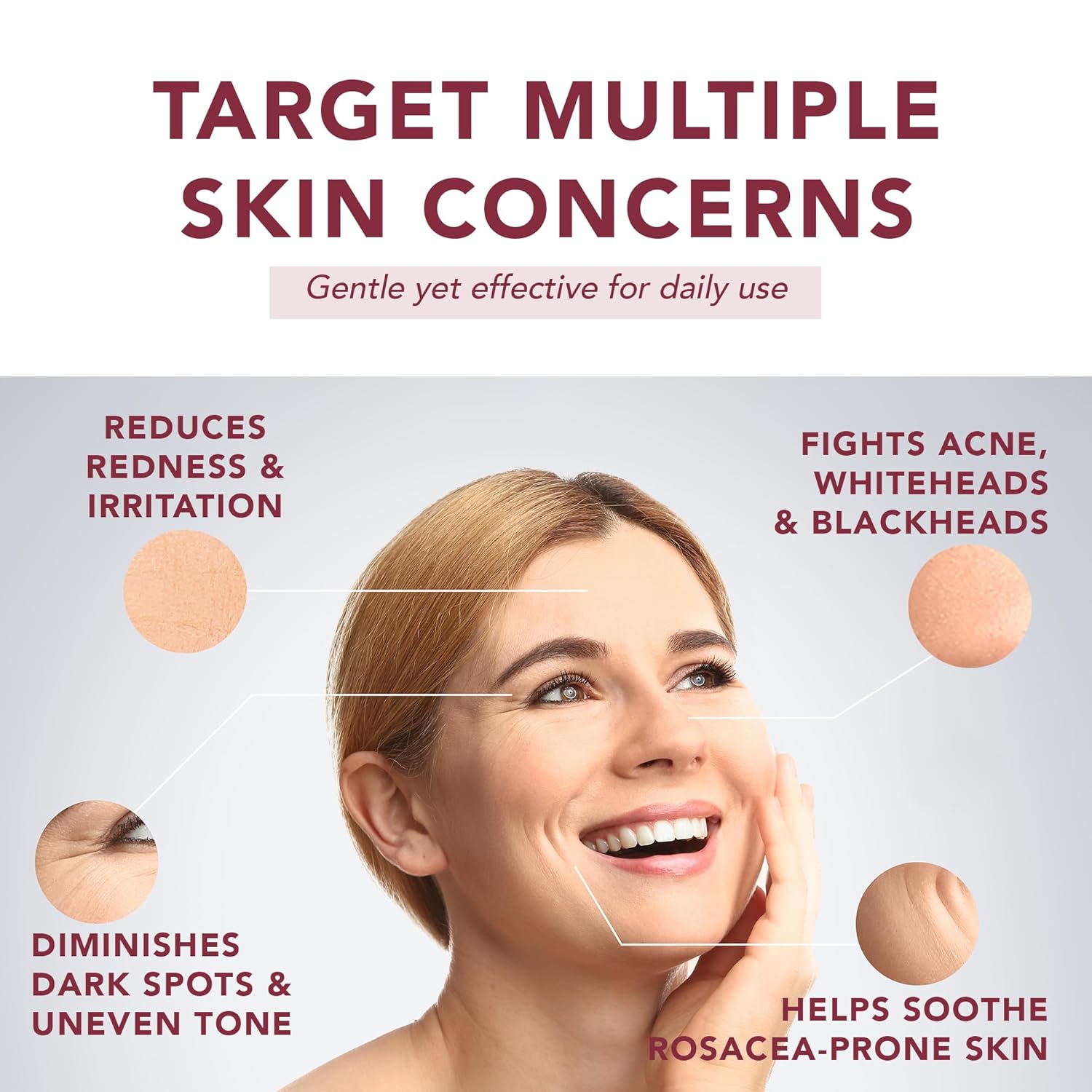 Detalle de Suquato Azelainsäure Serum 10% – Gesichtsserum mit Azelainsäure, Niacinamid und Hyaluronsäure (30 ml)
