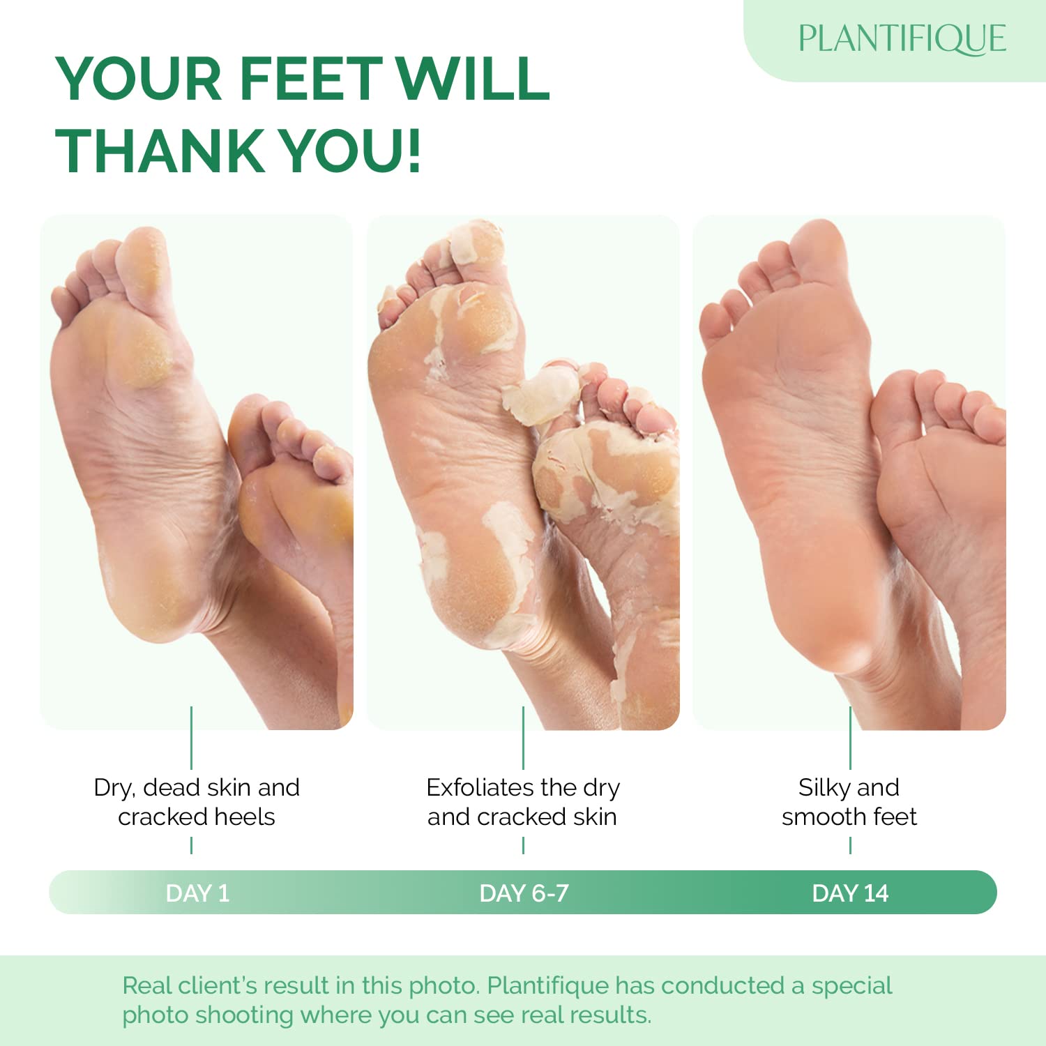 Detalle 2 de Plantifique Foot Peeling Mask 2 Pack