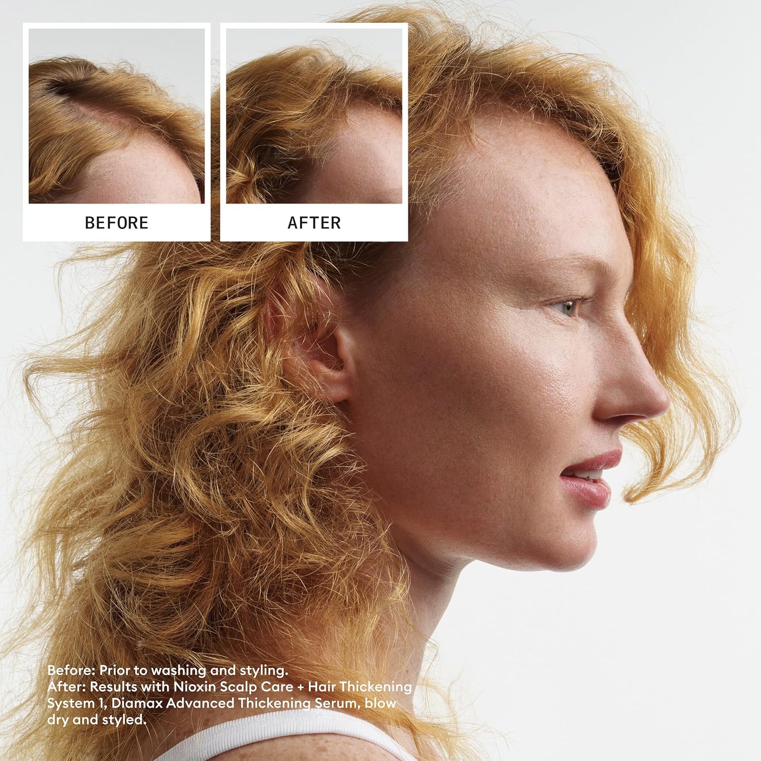 Thumbnail 5 de Nioxin System 1: Hair Thickening System for Naturally Thin Hair (Shampoo, Conditioner & Scalp Treatment)