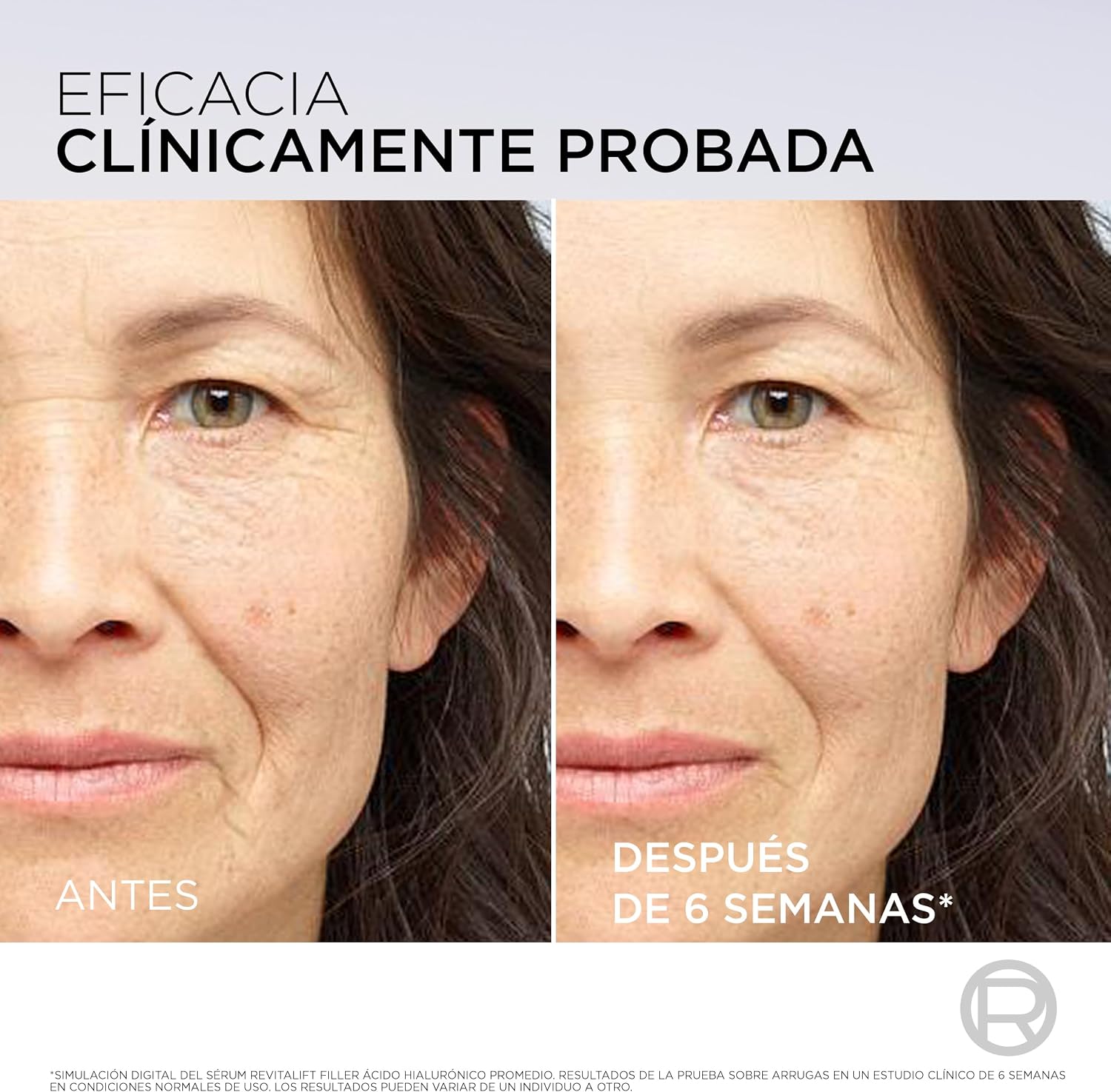 Thumbnail 6 de L'Oréal Paris Revitalift Filler Sérum Antiedad con Ácido Hialurónico 💧