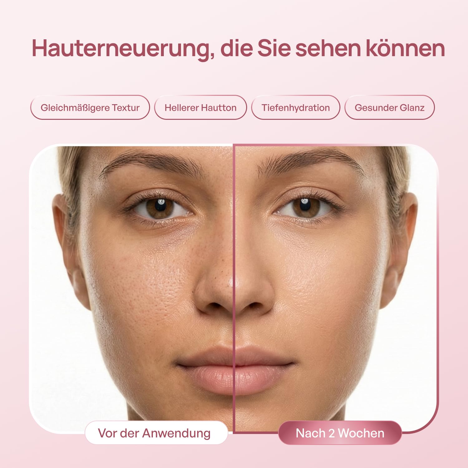 Detalle 2 de PLANTIFIQUE PDRN Microneedling Serum Gesichts Exosome 1500 PPM – Feuchtigkeit & Hautbarriere-Reparatur