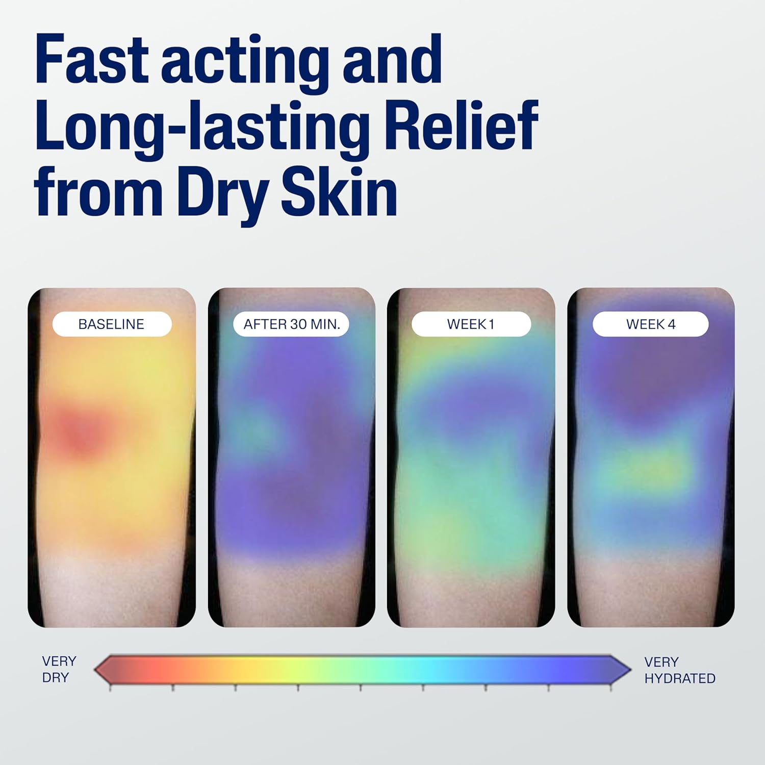 Thumbnail 4 de Cetaphil Face & Body Moisturizer Hydrating Moisturizing Cream (Fragrance-Free) for Dry to Very Dry, Sensitive Skin