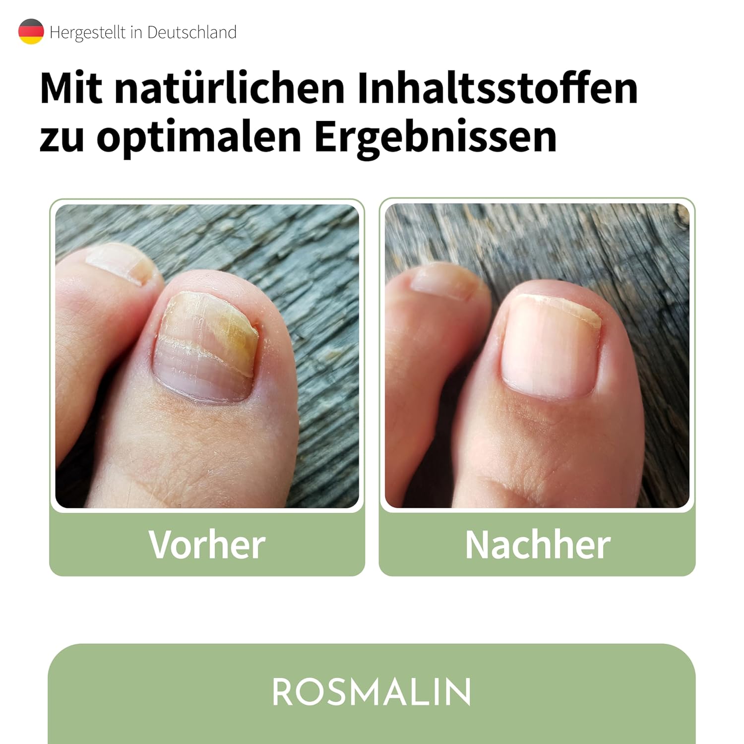 Detalle 2 de Rosmalin® Nail Care Pen 6 ml 💅