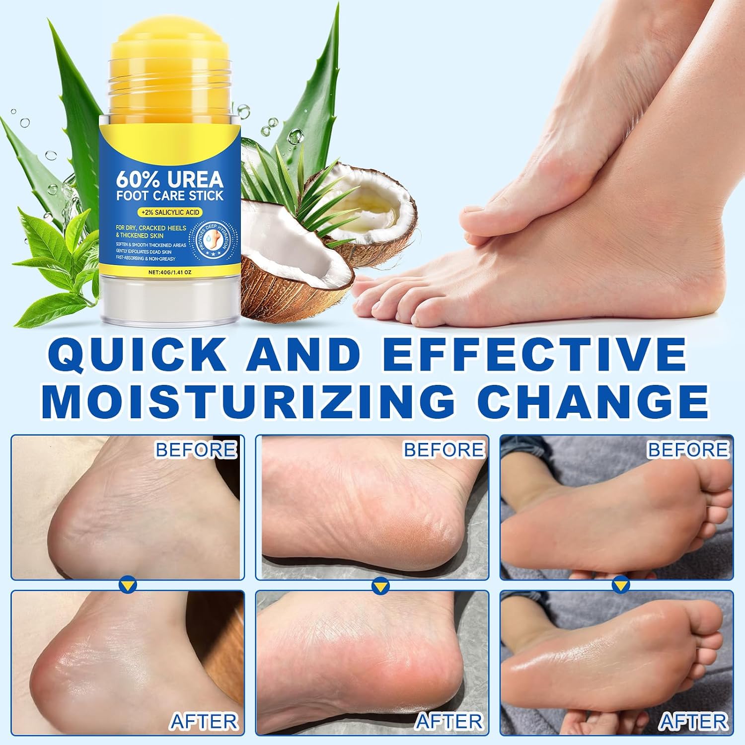 Detalle 2 de Urea Foot Care Stick with 60% Urea