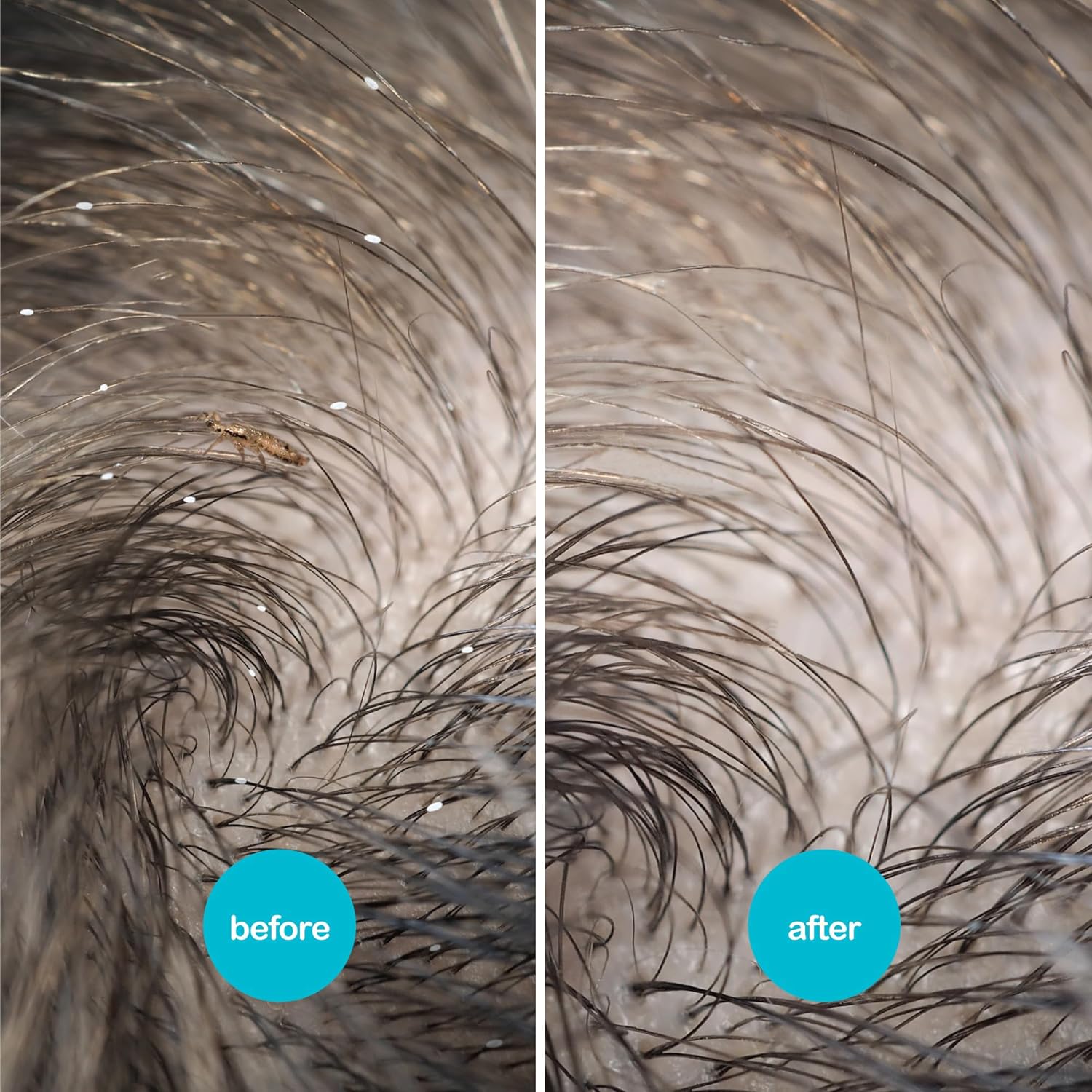 Thumbnail 4 de NitWits All-In-One Head Lice Treatment Spray (120ml) with Nit Comb