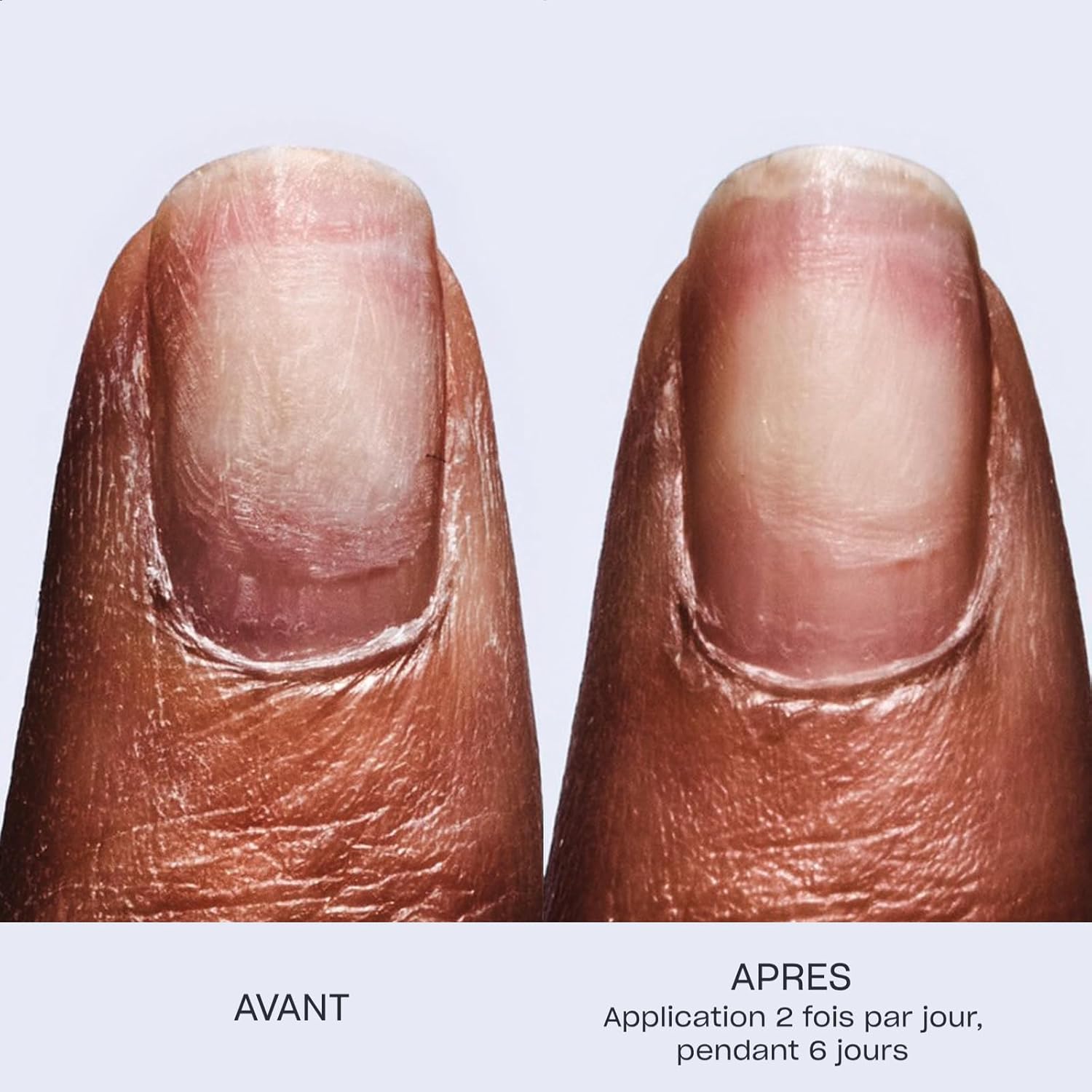 Thumbnail 3 de OPI Repair Mode – Sérum restructurant pour ongles fragiles et endommagés (formule vegan) – 9 ml