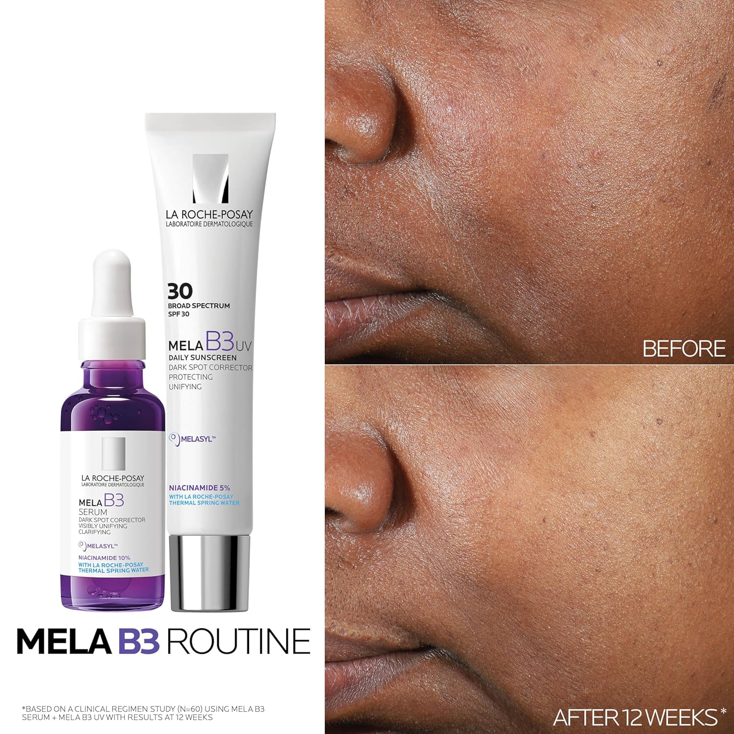 Detalle de La Roche-Posay Mela B3 Serum – Gegen Pigmentflecken, 50 ml