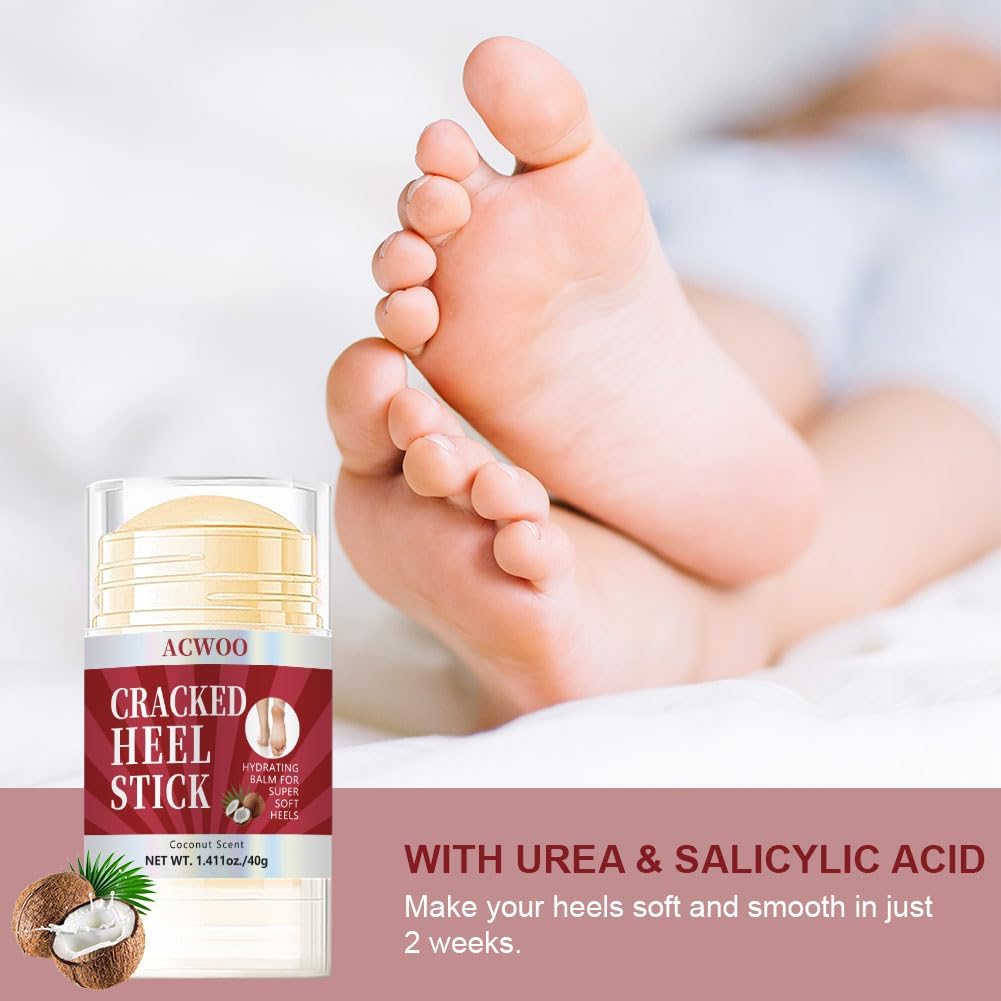 Detalle 2 de ACWOO Foot Cream – urea foot moisturiser for cracked heels and dry, rough skin