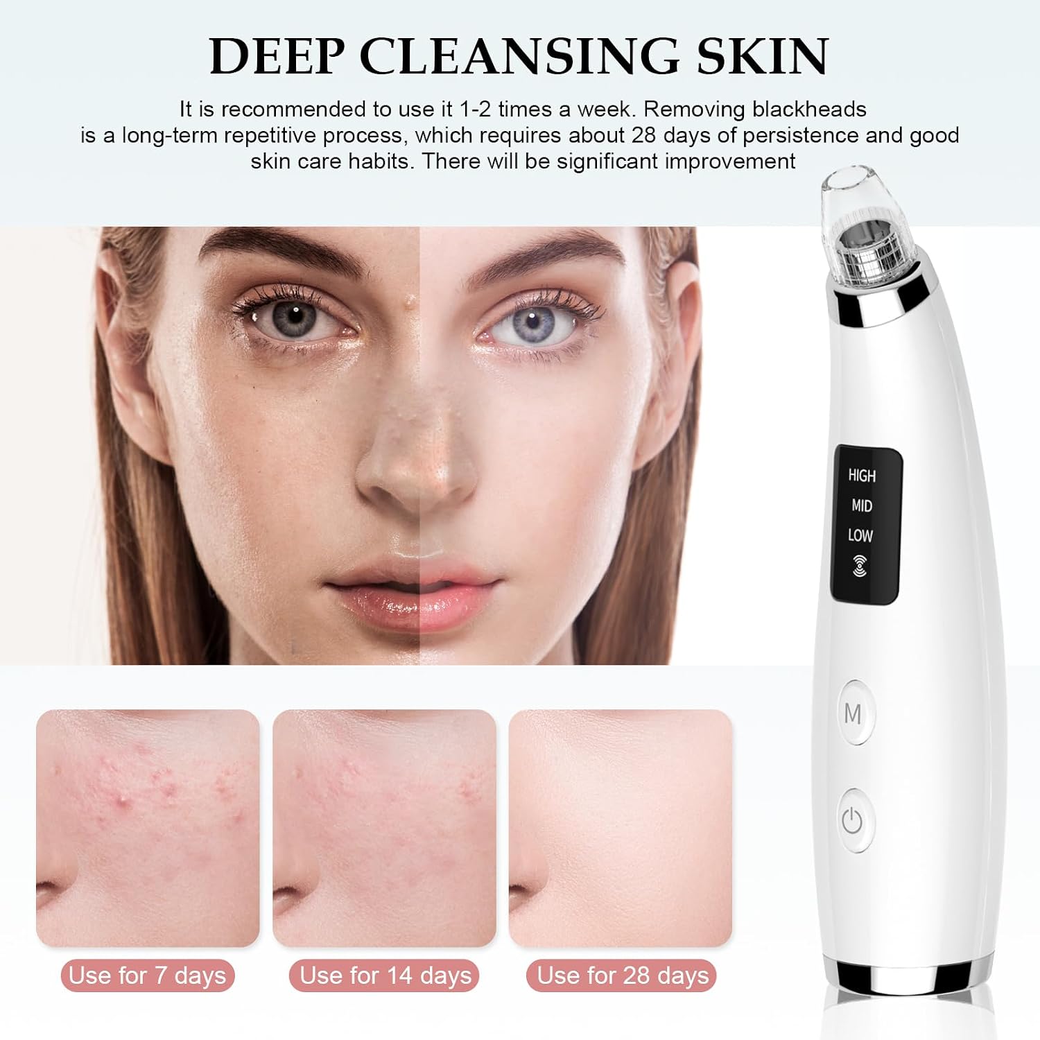 Thumbnail 3 de Blackhead Remover Pore Vacuum: 5 Probes, 3 Suction Levels, USB Rechargeable — White