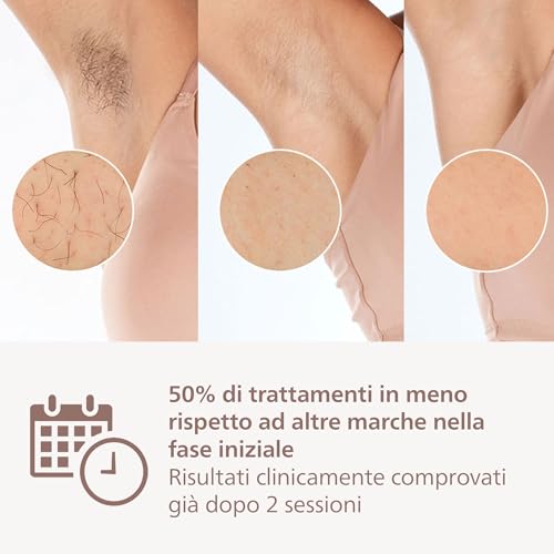 Detalle 2 de Philips Lumea 9000 Series BRI955/00 – Epilazione IPL con SenseIQ, 3 accessori e opzione cordless