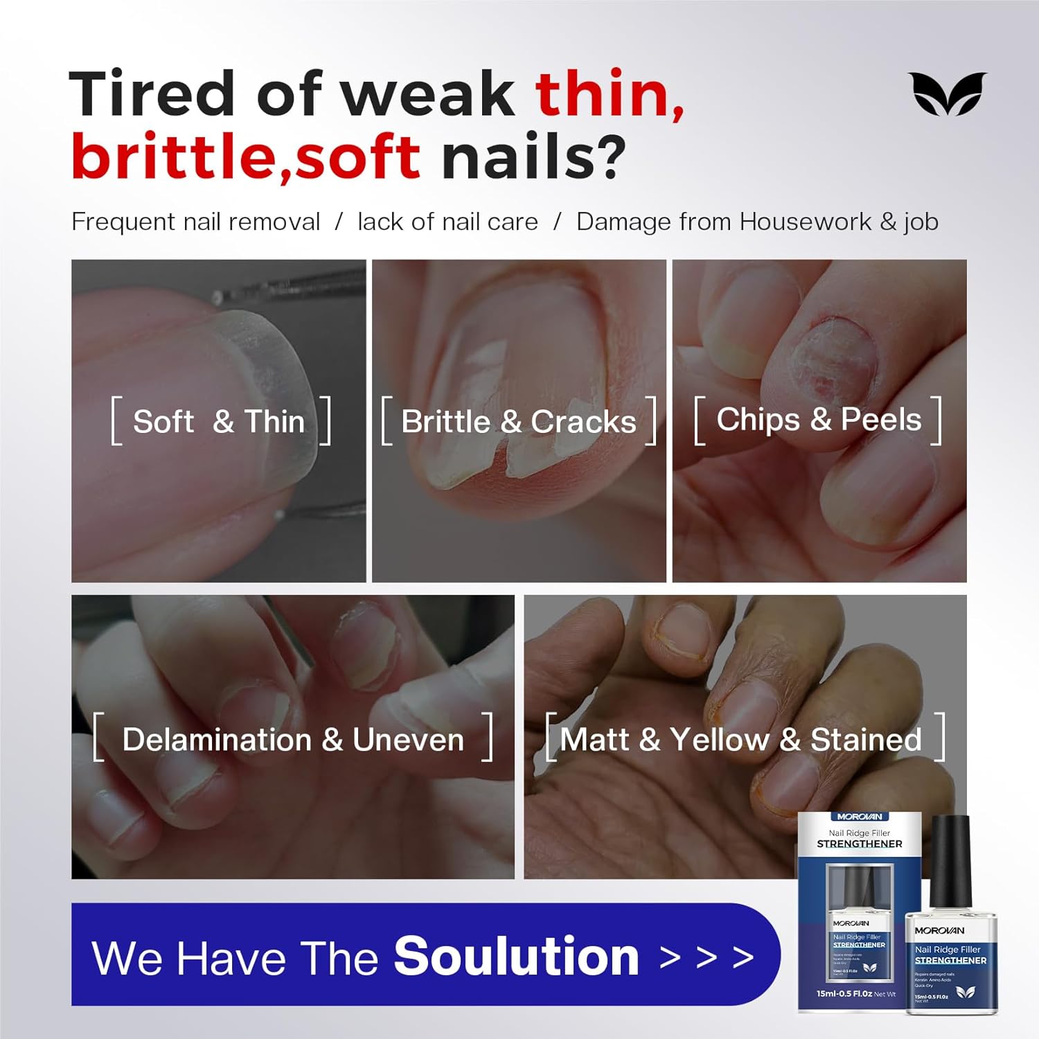 Thumbnail 1 de Morovan Nail Strengthener and Growth Milky White (Keratin + Calcium) Ridge Filler & Nail Repair Polish