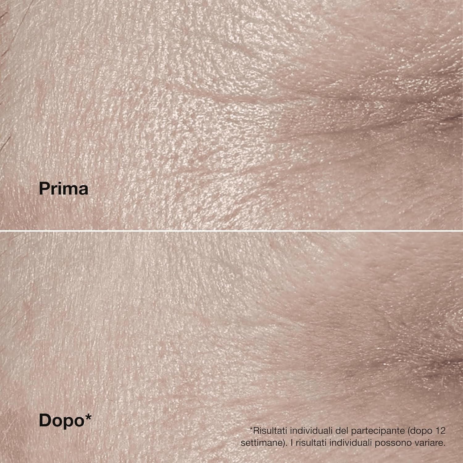 Detalle de Clinique Smart Clinical Repair Wrinkle Correcting Rich – Crema Viso Idratante anti-Età 50 ml