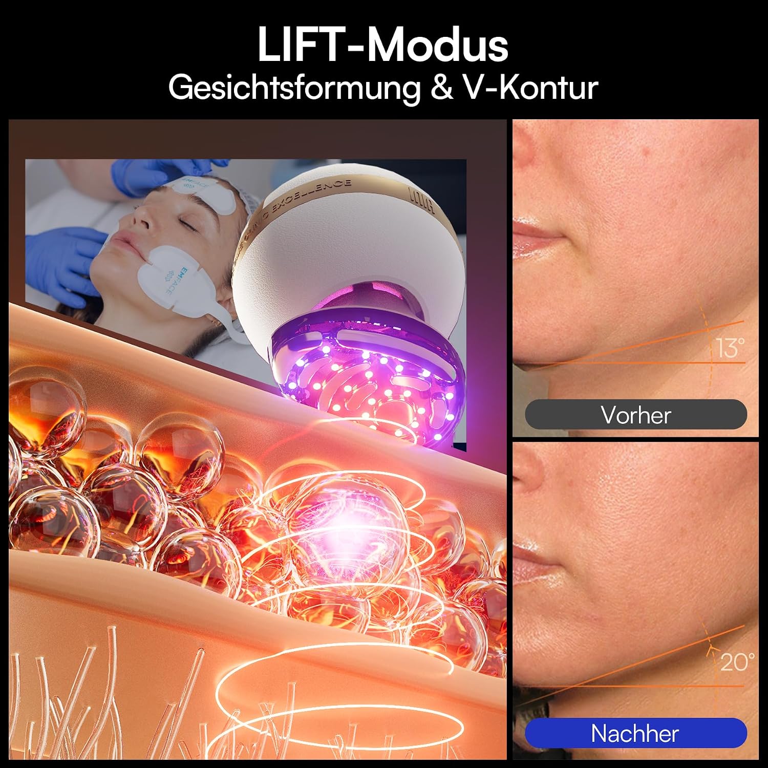 Detalle de INIA SPHERA Verbesserter 8-in-1 Mikrostrom-Gesichtsmassager mit Rotlicht, Wärme- & Kühlfunktion
