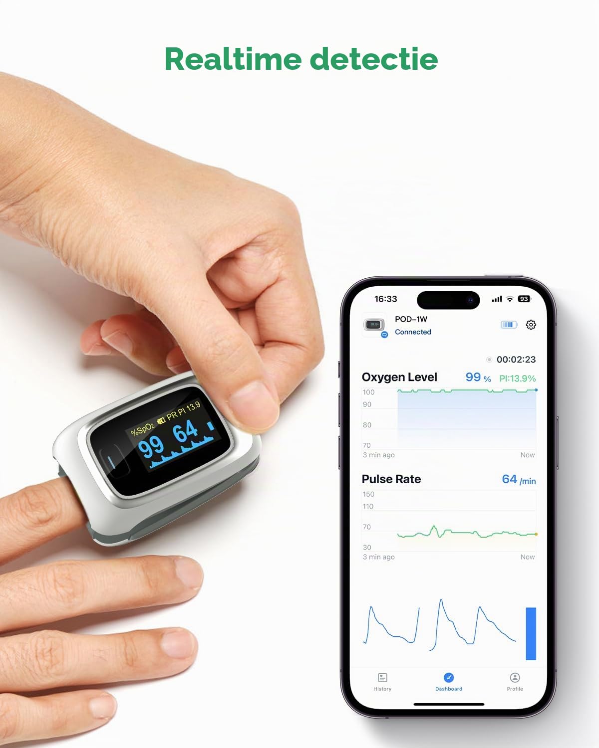 Detalle de ViATOM Checkme O2 pulsoximeter met Bluetooth, OLED-display en app