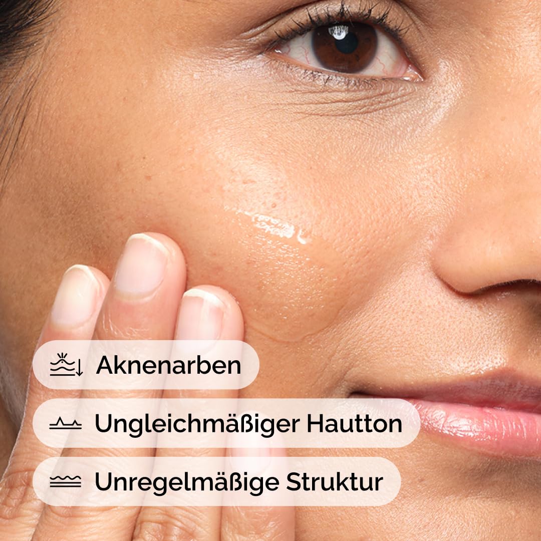 Detalle 2 de The Ordinary Aloe 2% + NAG 2% Solution (30 ml) – beruhigende Pflege gegen Aknenarben
