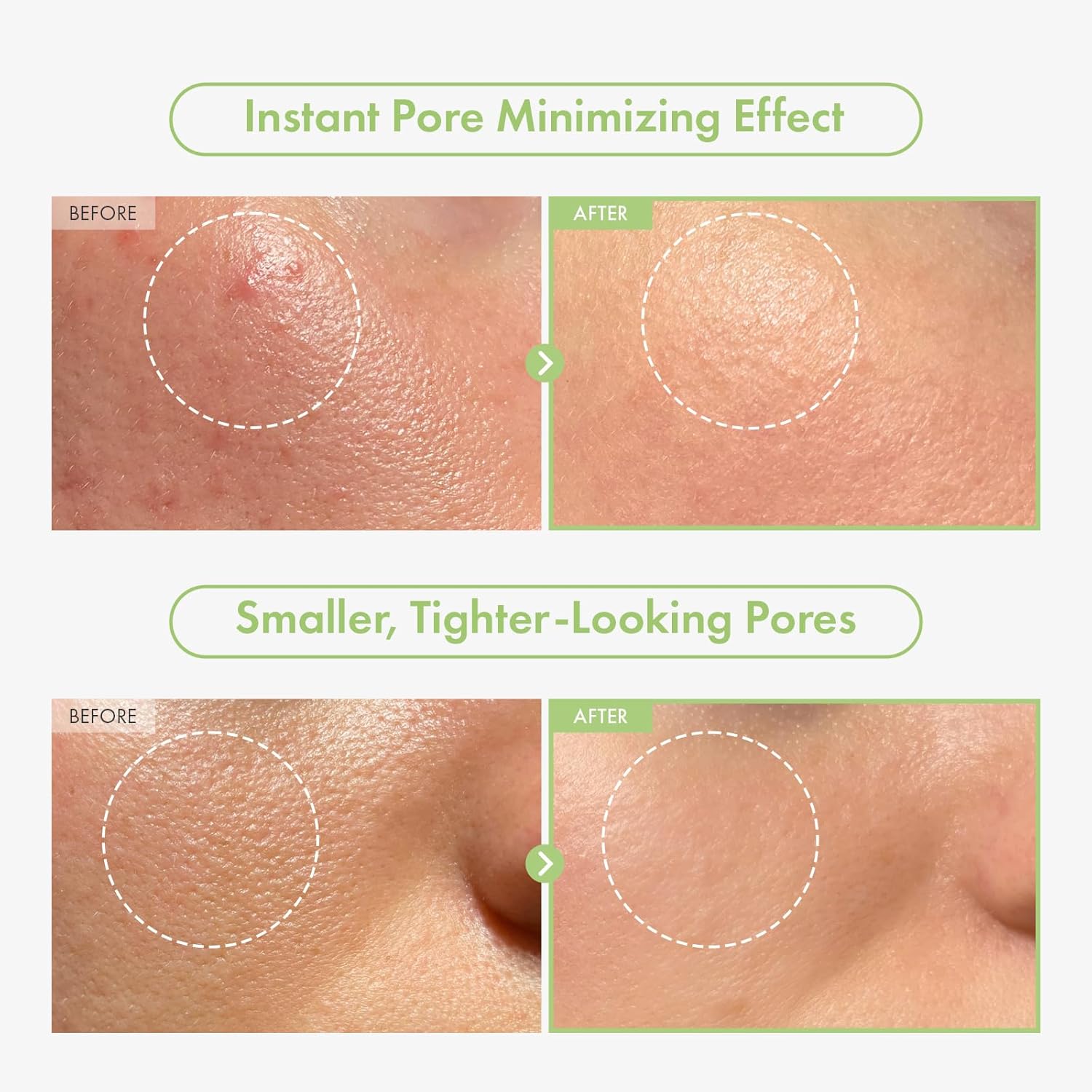 Detalle de TOSOWOONG Siero ai Caviali Verdi per i Pori con 2.500ppm di Caviale Verde, niacinamide e minimizzatore dei pori (33 ml)