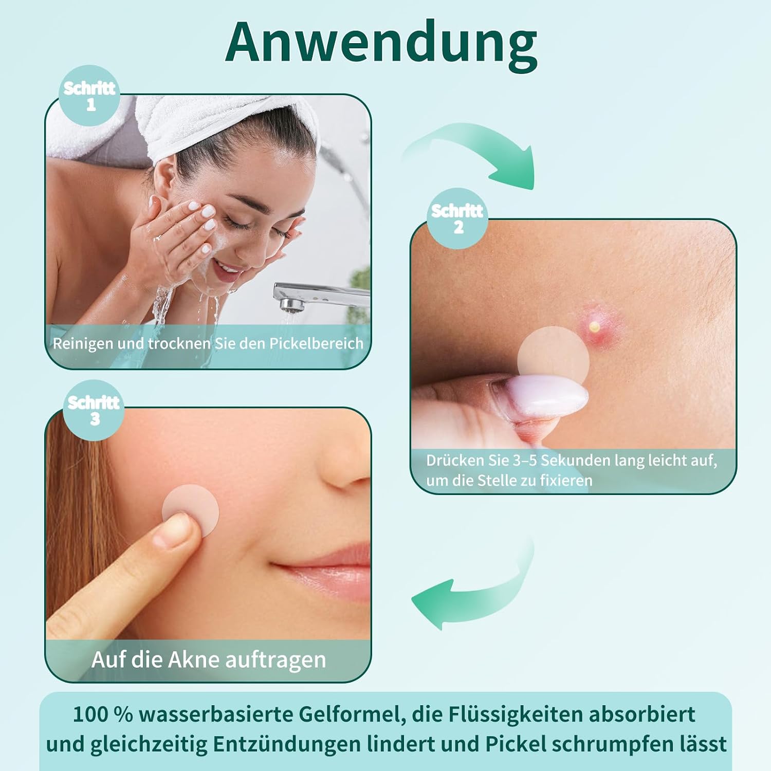 Thumbnail 5 de ALULU 360er Pickel Patch – Hydrokolloid Patches in 3 Größen (12/10/8 mm) mit Teebaumöl, wasserdicht & atmungsaktiv