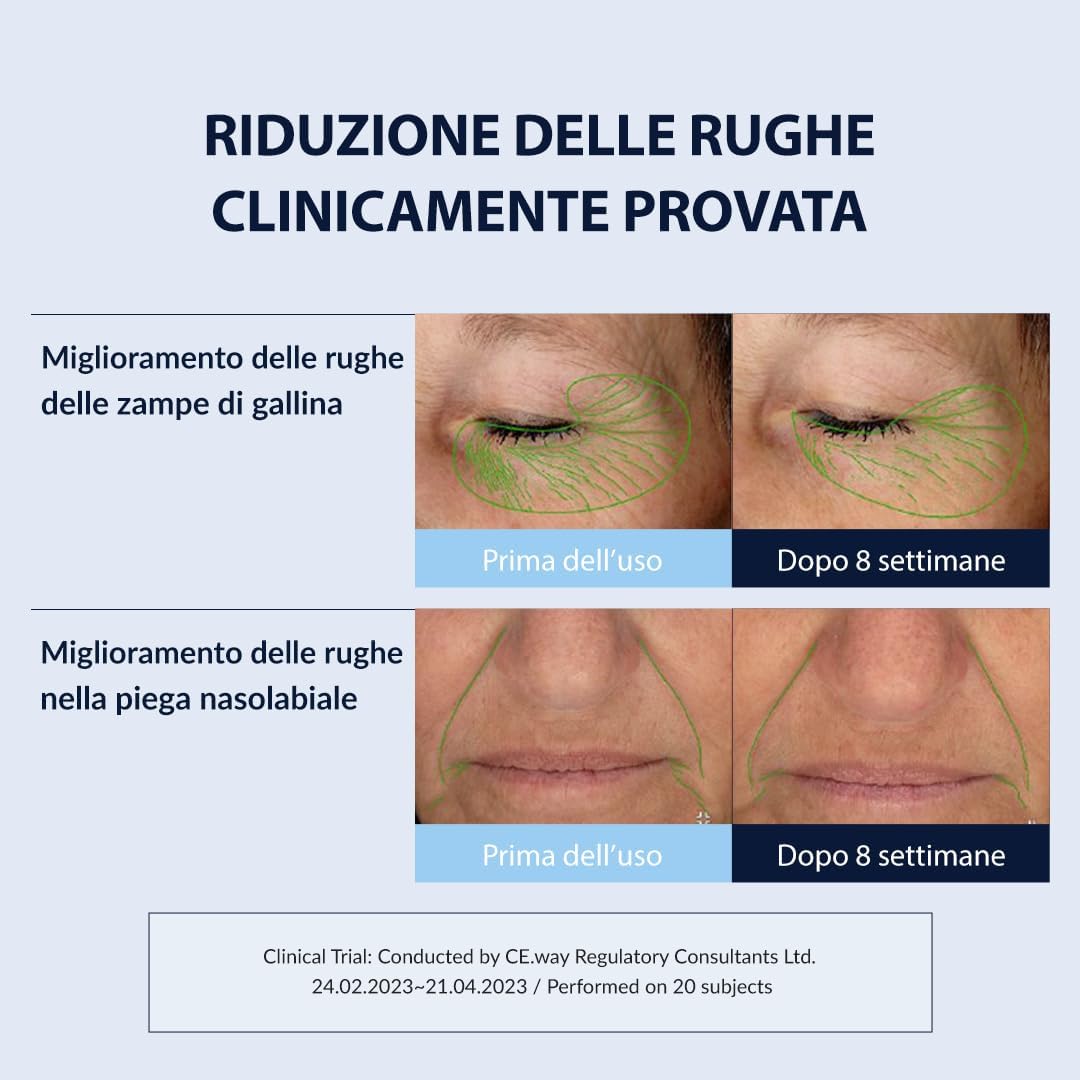 Thumbnail 3 de MIZON 0.3% Retinol Youth Cream 26G