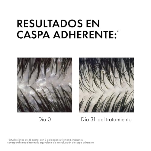 Thumbnail 2 de Vichy Champú Anticaspa Dercos Technique para Cabellos Grasos (390 ml) – doble acción contra la caspa y picores