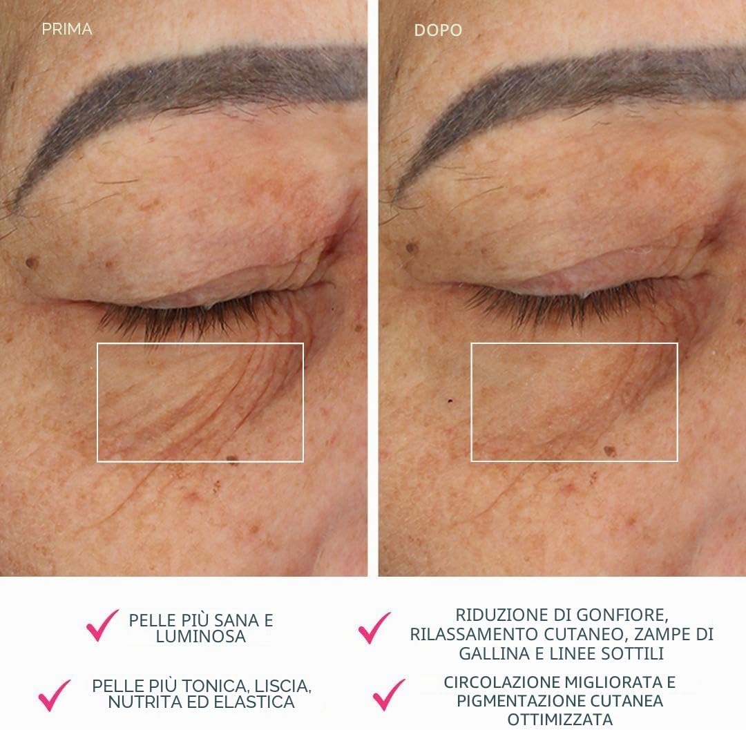 Thumbnail 4 de FOREO Bear massaggiatore viso antiage 5 livelli