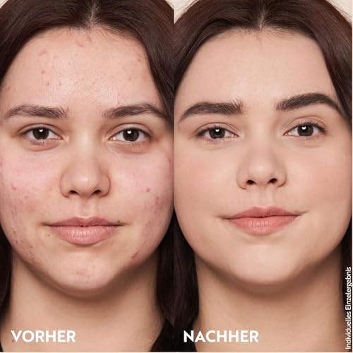 Thumbnail 10 de M. Asam Magic Finish Make Up Mousse Classic (30 ml) – 4-in-1 Make-up, Primer, Concealer & Puder