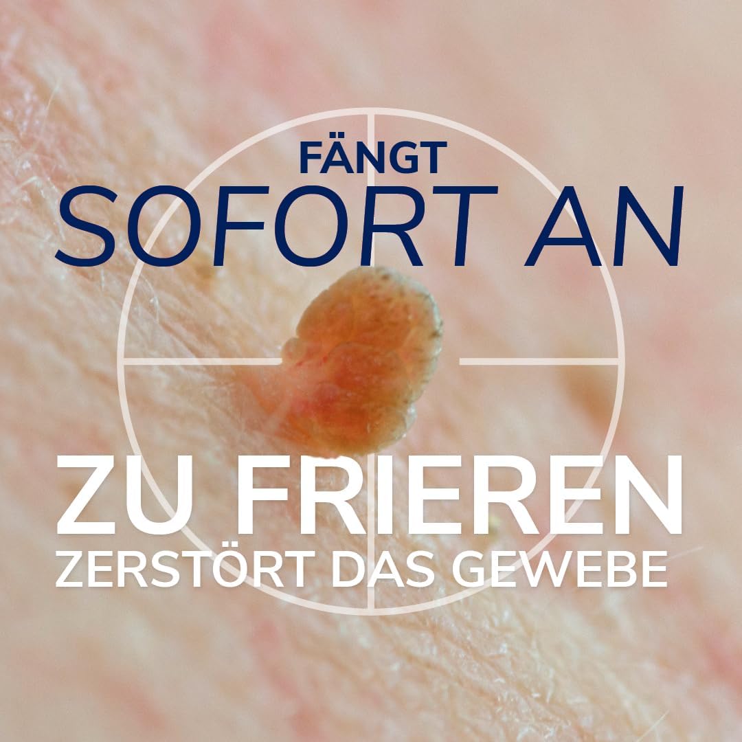 Detalle de Scholl Freeze Away Stielwarzen-Entferner-Set – Stielwarzen sicher zu Hause entfernen, 12 Behandlungen