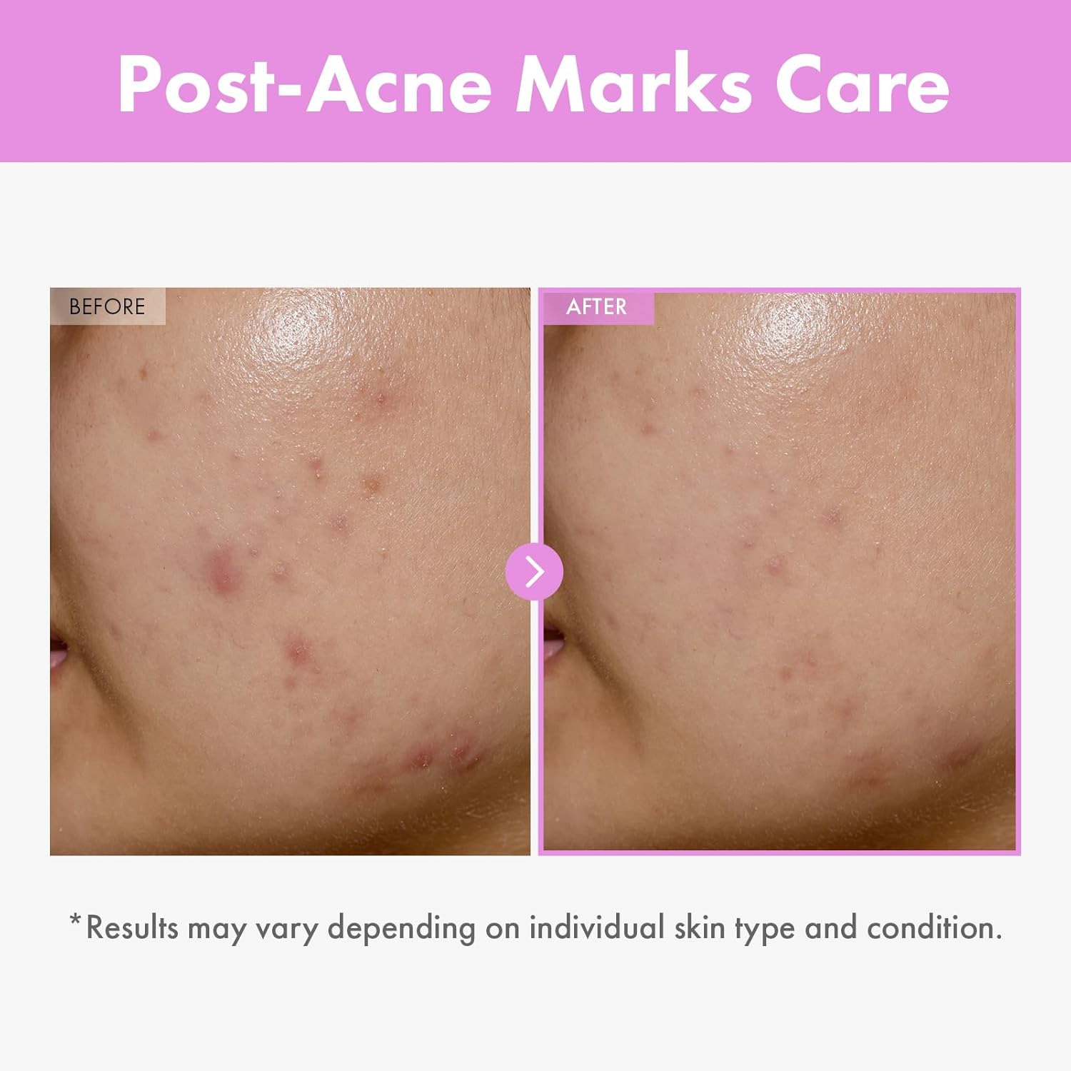 Thumbnail 2 de TOSOWOONG 9 Peptide Skin Booster Siero: siero viso potenziante con 9 peptidi, Niacinamide e acido ialuronico
