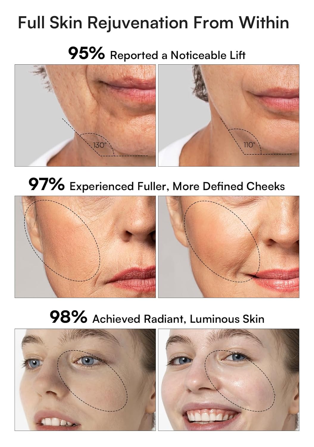 Thumbnail 2 de INIA Flare 3-in-1 Skin Tightening Device