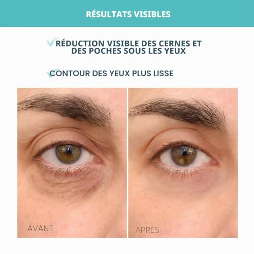 Detalle de FOREO Iris Vitamin C Eye Cream – Soin contour des yeux à la vitamine C et caféine, 15 ml