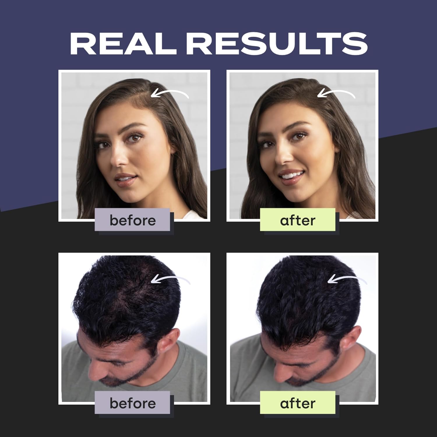 Thumbnail 2 de Toppik Hair Building Fibres Powder 3g — brown 💇