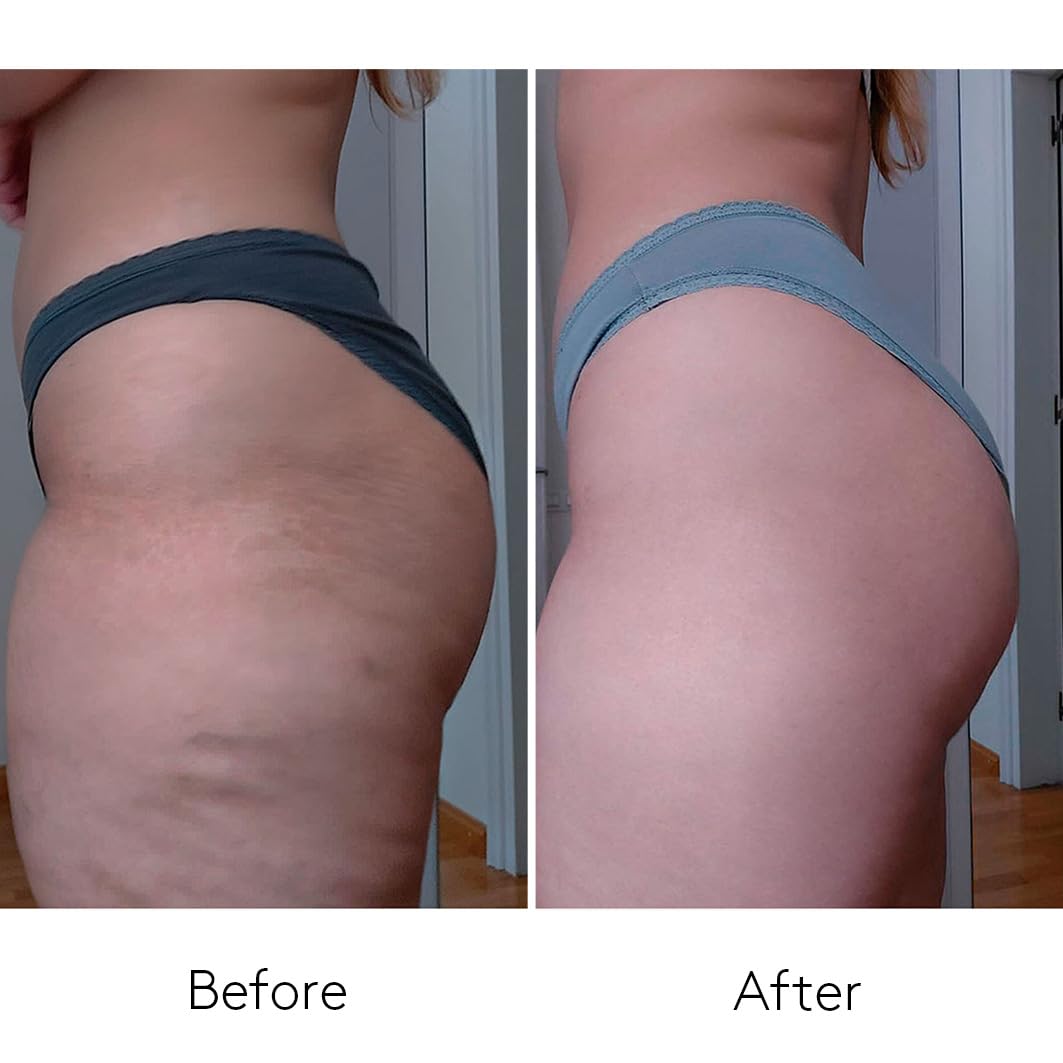 Thumbnail 4 de Body Power Smart Burn Anti-Cellulite 150 ml
